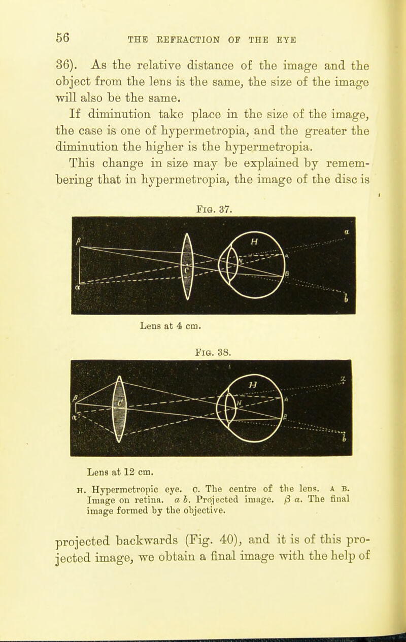 36). As the relative distance of tlie image and tlie object from tlie lens is the same, the size of the image will also be the same. If diminution take place in the size of the image, the case is one of hypermetropia, and the greater the diminution the higher is the hypermetropia. This change in size may be explained by remem- bering that in hypermetropia, the image of the disc is Pig. 37. Lens at 4 cm. Fig. 38. A - ^ 1 Lens at 12 cm. H. Hypermetropic eye. 0. The centre of the lens. A B. Image on retina, a h. Projected image. j3 a. The final image formed by the objective. projected backwards (Fig. 40), and it is of this pro- jected image, we obtain a final image with the help of