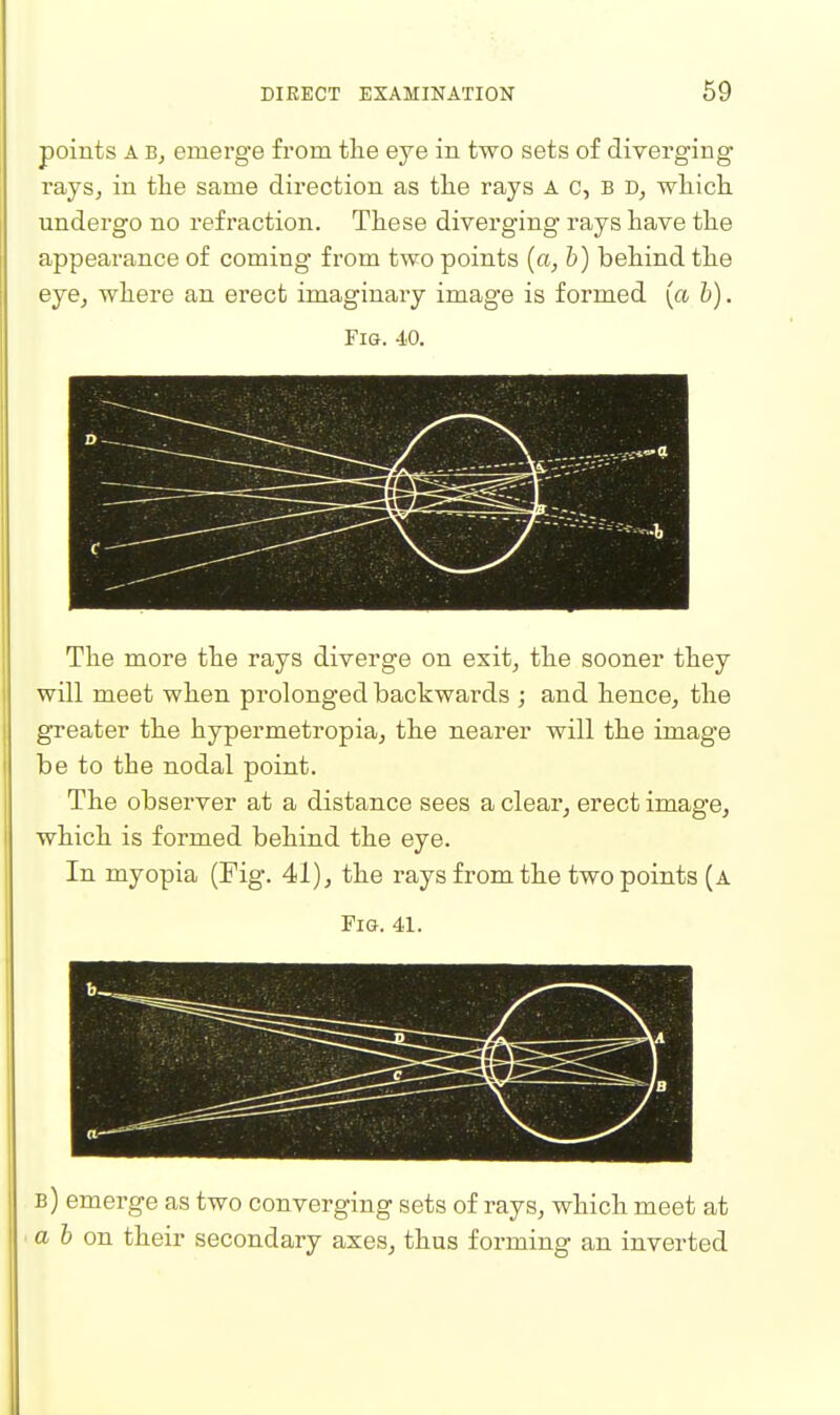 points A B, emerge from the eye in two sets of diverging raySj in the same direction as the rays A c, B which undergo no refraction. These diverging rays have the appearance of coming from two points {a, h) behind the eje, where an erect imaginary image is formed {a b). Fig. 40. The more the rays diverge on exitj the sooner they will meet when prolonged backwards ; and hence, the greater the hypermetropia, the nearer will the image be to the nodal point. The observer at a distance sees a clear, erect image, which is formed behind the eye. In myopia (Fig. 41), the rays from the two points (a Fig. 41. b-__ ^ v. T —^ b) emerge as two converging sets of rays, which meet at a 6 on their secondary axes, thus forming an inverted