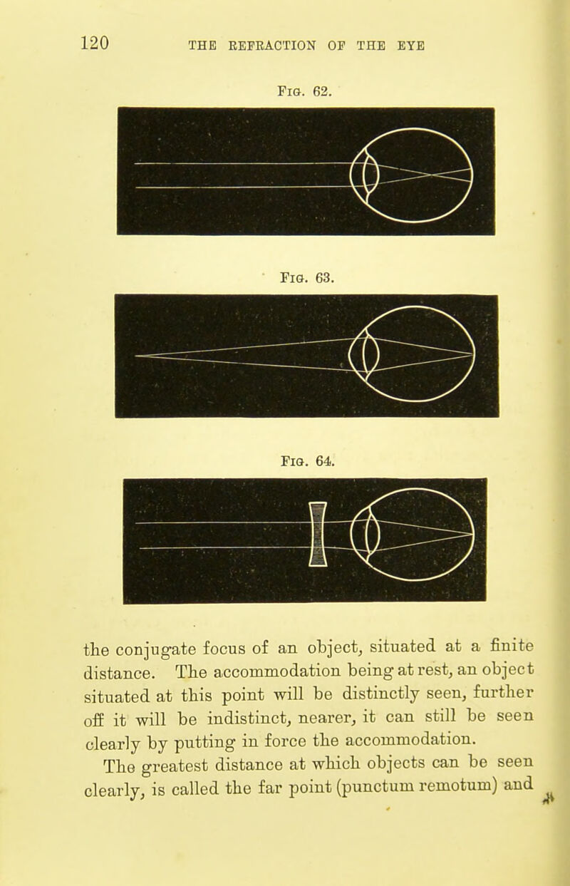 Fig. 62. the conjugate focus of an object, situated at a finite distance. The accommodation being at rest, an object situated at this point will be distinctly seen, further ofi it will be indistinct, nearer, it can still be seen clearly by putting in force the accommodation. The greatest distance at which objects can be seen clearly, is called the far point (punctum remotum) and
