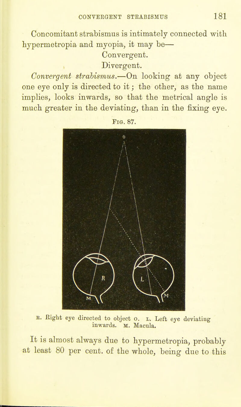 Concomitant strabismus is intimately connected with hypermetropia and myopia^ it may be— Convergent. Divergent. Convergent strabismus.—On looking at any object one eye only is directed to it; tbe other, as the name implies, looks inwards, so that the metrical angle is much greater in the deviating, than in the fixing eye. Pio. 87. E. Right eye directed to object o. l. Left eye deviating inwards. M. Macula. It is almost always due to hypermetropia, probably at least 80 per cent, of the whole, being due to this