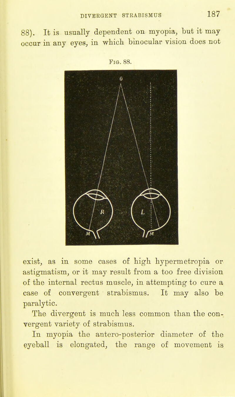 88). It is usually dependent on myopia, but it may occur in any eyes, in which binocular vision does not Fig. 88. exist, as in some cases of high, bypermetropia or astigmatism, or it may result from a too free division of tbe internal rectus muscle, in attempting to cure a case of convergent strabismus. It may also be paralytic. Tbe divergent is much less common than the con- vergent variety of strabismus. In myopia the antero-posterior diameter of the eyeball is elongated, the range of movement is