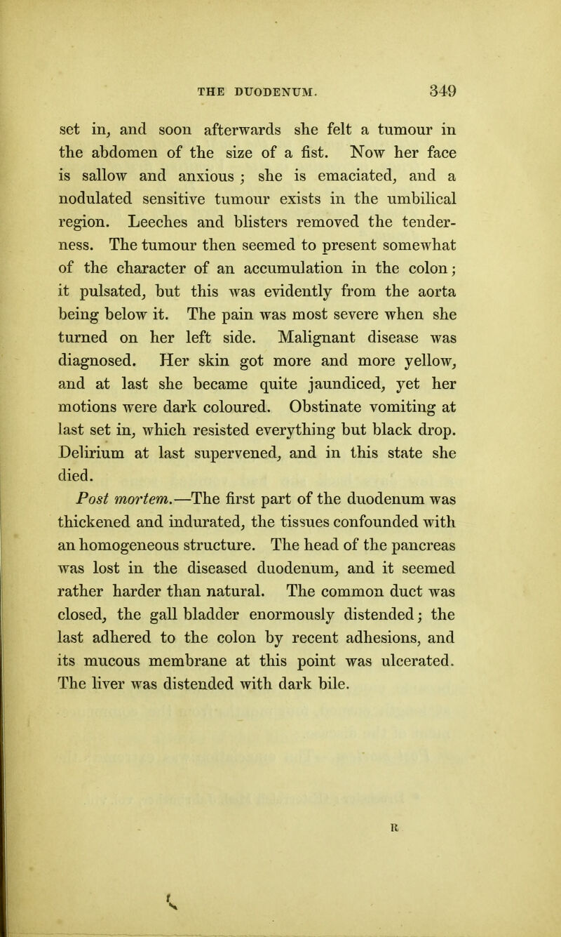 set in, and soon afterwards she felt a tumour in the abdomen of the size of a fist. Now her face is sallow and anxious ; she is emaciated, and a nodulated sensitive tumour exists in the umbilical region. Leeches and blisters removed the tender- ness. The tumour then seemed to present somewhat of the character of an accumulation in the colon; it pulsated, but this was evidently from the aorta being below it. The pain was most severe when she turned on her left side. Malignant disease was diagnosed. Her skin got more and more yellow, and at last she became quite jaundiced, yet her motions were dark coloured. Obstinate vomiting at last set in, which resisted everything but black drop. Delirium at last supervened, and in this state she died. Post mortem.—The first part of the duodenum was thickened and indurated, the tissues confounded with an homogeneous structure. The head of the pancreas was lost in the diseased duodenum, and it seemed rather harder than natural. The common duct was closed, the gall bladder enormously distended; the last adhered to the colon by recent adhesions, and its mucous membrane at this point was ulcerated. The liver was distended with dark bile. R