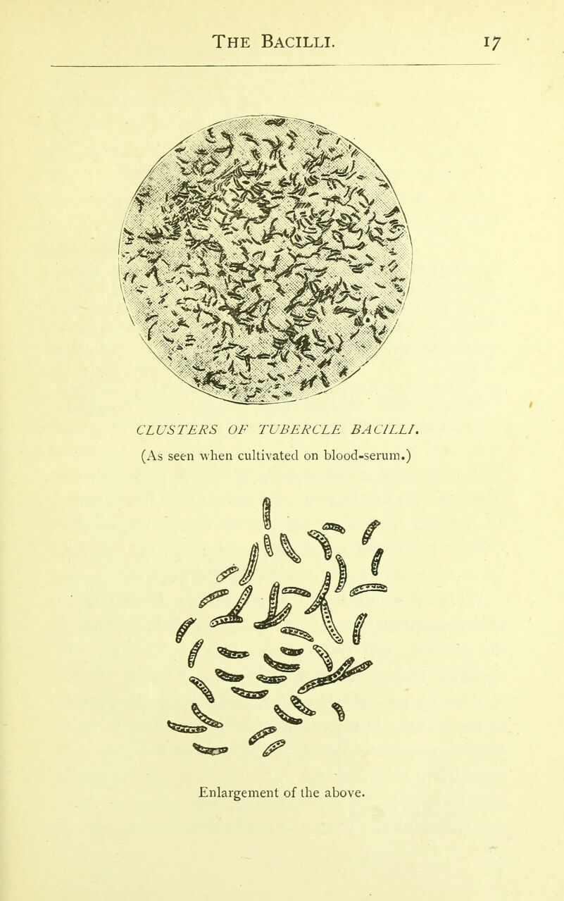 1 CLUSTERS OF TUBERCLE BACILLI. (As seen when cultivated on blood-serum.) Enlargement of the above.