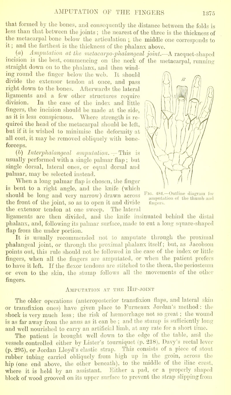 that formed by the bones, and consequently the distance between the folds is less than that between the joints ; the nearest of the three is the thickness of the metacarpal bone below the articulation ; the middle one corresponds to it; and the farthest is the thickness of the phalanx above. (a) Aviputatioii at tJte metacarpo-phalmigcal joint.—A racquet-shaped incision is the best, commencing on the neck of the metacarpal, running- straight down on to the phalanx, and then wind- ing round the finger below tlie web. It should divide the extensor tendon at once, and pass right down to the bones. Afterwards the lateral ligaments and a few other structures require •division. In the case of the index and httle fingers, the incision should be made at the side, as it is less conspicuous. Where strength is re- quired the head of the metacarpal should be left, but if it is wished to minimise the deformity at all cost, it may be removed obliquely with bone- forceps. {h) Interplialanrjcal amj) id at ion.— This is usually performed with a single palmar flap ; but single dorsal, lateral ones, or equal dorsal and palmar, may be selected instead. When a long palmar flap is chosen, the finger is bent to a right angle, and the knife (which should be long and very narrow) drawn across the front of the joint, so as to open it and divide the extensor tendon at one sweep. The lateral ligaments are then divided, and the knife insinuated behind the distal phalanx, and, following its palmar surface, made to cut a long square-shaped flap from the under portion. It is usually recommended not to amputate through the proximal phalangeal joint, or through the proximal phalanx itself; but, as Jacobson points out, this rule should not be followed in the case of the index or little fingers, when all the fingers are amputated, or when the patient prefers to have it left. If the flexor tendons are stitched to the theca, the periosteum or even to the skin, the stump follows all the movements of the other Pig. 484.—Outline diagram for amputation of the thumb an<l fingers. fingers. Amputation at the Hip-joint The older operations (anteroposterior transfixion flaps, and lateral skin or transfixion ones) have given place to Furneaux .Jordan's method: the shock is very much less ; the risk of haemorrhage not so great; the wound is as far away from the anus as it can be ; and tlie stump is sufficiently long and well nourished to carry an artificirJ limb, at any rate for a short time. The patient is brought well down to the edge of the table, arid the vessels controlled either by Lister's tourniq-uet (p. 218), Davy's rectal lever (p. 295), or Jordan Lloyd's elastic strap. This consists of a piece of stoTit rubber tubing carried obliquely from high up in the groin, across the hip (one end above, the other beneath), to the middle of the iliac crest, where it is held by an assistant. Either a pad, or a properly shaped block of wood grooved on its upper surface to prevent the strap slipping from