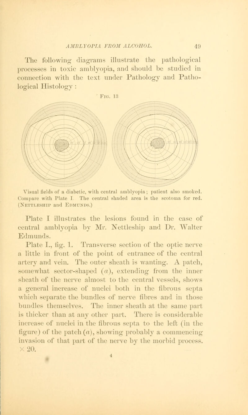 , I MBL YOl'I. I FROM ALCOHOL. 49 The followiDg diagrams illustrate the pathological processes in toxic amblyopia, and should be studied in connection with the text under Pathology and Patho- logical Histology : ' Fig. 13 Visual fields of a diabetic, with central amblyopia; patient also smoked. Compare with Plate I The central shaded area is the scotoma for red. (Nettleship and Edmunds.) Plate I illustrates the lesions found in the case of central amblyopia by Mr. Nettleship and Dr. Walter Edmunds. Plate I., fig. 1. Transverse section of the optic nerve a little in front of the point of entrance of the central artery and vein. The outer sheath is wanting. A patch, somewhat sector-shaped (a), extending from the inner sheath of the nerve almost to the central vessels, shows a general increase of nuclei both in the fibrous septa which separate the bundles of nerve fibres and in those bundles themselves. The inner sheath at the same part is thicker than at any other part. There is considerable increase of nuclei in the fibrous septa to the left (in the figure) of the patch (a), showing probably a commencing invasion of that part of the nerve by the morbid process, x 20.