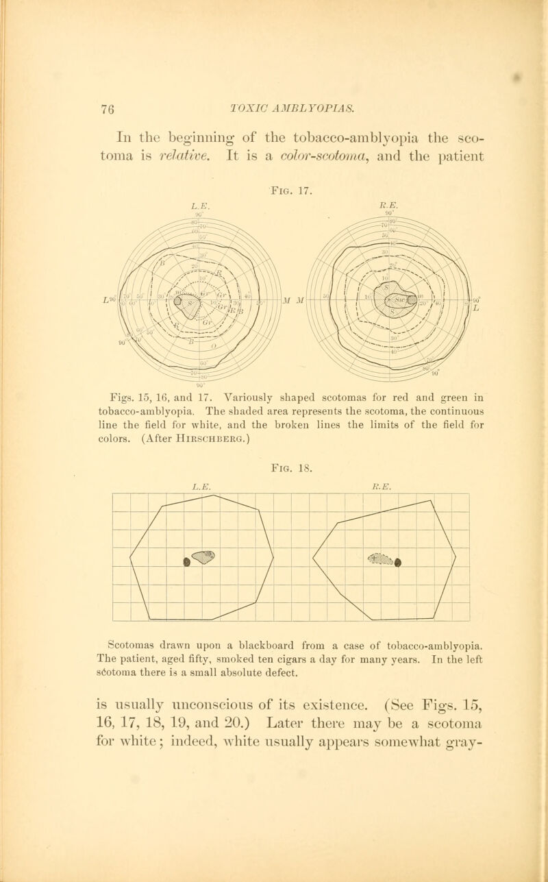 In the beginning of the tobacco-amblyopia the sco- toma is relative. It is a color-scotoma, and the patient Fig. 17. L.E. R.E. L-> M M Figs. 15, 16, and 17. Variously shaped scotomas for red and green in tobacco-amblyopia. The shaded area represents the scotoma, the continuous line the field for white, and the broken lines the limits of the field for colors. (After Hirschberg.) Fig. 18. L.E. Scotomas drawn upon a blackboard from a case of tobacco-amblyopia. The patient, aged fifty, smoked ten cigars a day for many years. In the left scotoma there is a small absolute defect. is usually unconscious of its existence. (See Figs. 15, 16, 17, 18, 19, and 20.) Later there may be a scotoma for white; indeed, white usually appears somewhat gray-