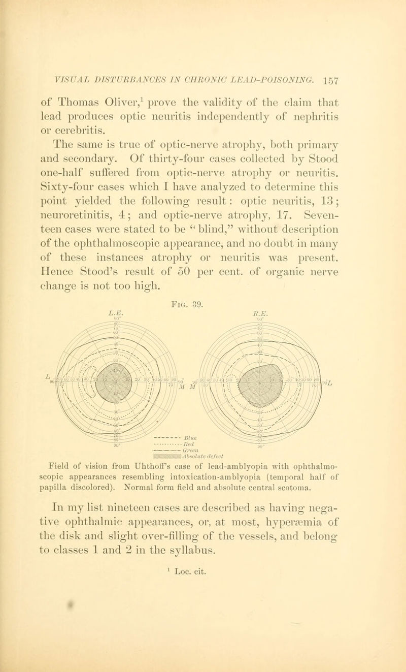 of Thomas Oliver,1 prove the validity of the claim that lead produces optic neuritis independently of nephritis or cerebritis. The same is true of optic-nerve atrophy, both primary and secondary. Of thirty-four cases collected by Stood one-half suffered from optic-nerve atrophy or neuritis. Sixty-four cases which I have analyzed to determine this point yielded the following result: optic neuritis, 13; neuroretinitis, 4; and optic-nerve atrophy, 17. Seven- teen cases were stated to be  blind, without description of the ophthalmoscopic appearance, and no doubt in many of these instances atrophy or neuritis was present. Hence Stood's result of 50 per cent, of organic nerve change is not too high. Fig. 39. L.E. R.E. ML Blue ■ Red Green ■SUSHIS* Absolute defect Field of vision from UhthofFs case of lead-amblyopia with ophthalmo- scopic appearances resembling iutoxication-amblyopia (temporal half of papilla discolored). Normal form field and absolute central scotoma. In my list nineteen cases are described as having nega- tive ophthalmic appearances, or, at most, hyperemia of the disk and slight over-filling of the vessels, and belong- to classes 1 and 2 in the syllabus.