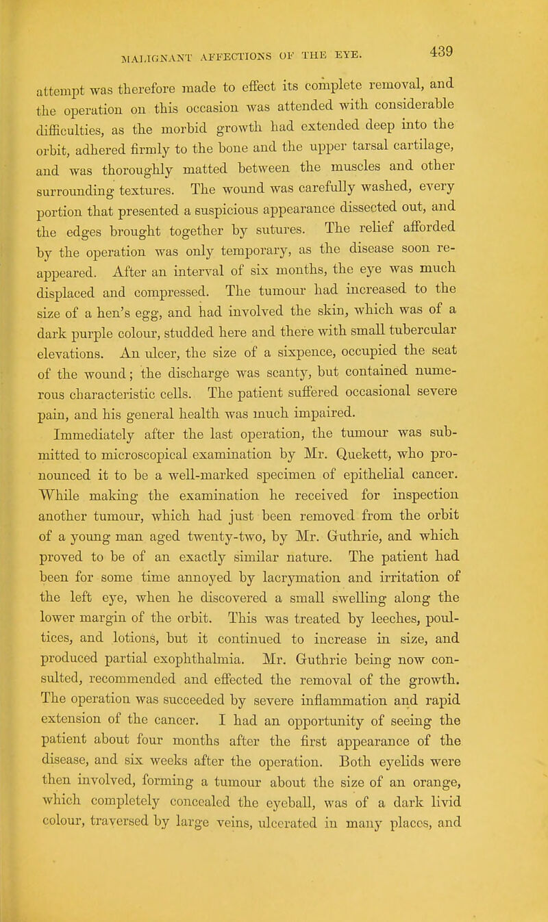 attempt was therefore made to effect its complete removal, and the operation on this occasion was attended with considerable difficulties, as the morbid growth had extended deep into the orbit, adhered firmly to the bone and the upper tarsal cartilage, and was thoroughly matted between the muscles and other surrounding textures. The wound was carefully washed, every portion that presented a suspicious appearance dissected out, and the edges br ought together by sutures. The relief afforded by the operation was only temporary, as the disease soon re- appeared. After an interval of six months, the eye was much displaced and compressed. The tumoui' had increased to the size of a hen's egg, and had involved the skin, which was of a dark purple colour, studded here and there with small tubercular elevations. An ulcer, the size of a sixpence, occupied the seat of the wound; the discharge was scanty, but contained nume- rous characteristic cells. The patient suffered occasional severe pain, and his general health was much impaired. Immediately after the last operation, the tumour was sub- mitted to microscopical examination by Mr. Quekett, who pro- nounced it to be a well-marked specimen of epithelial cancer. While making the examination he received for inspection another tumour, which had just been removed from the orbit of a young man aged twenty-two, by Mr. Guthrie, and which proved to be of an exactly similar nature. The patient had been for some time annoyed by lacrymation and irritation of the left eye, when he discovered a small swelling along the lower margin of the orbit. This was treated by leeches, poul- tices, and lotions, but it continued to increase in size, and produced partial exophthalmia. Mr. Guthrie being now con- sulted, recommended and effected the removal of the growth. The operation was succeeded by severe inflammation and rapid extension of the cancer. I had an opportmiity of seeing the patient about four months after the first appearance of the disease, and six weeks after the operation. Both eyelids were then involved, forming a tumour about the size of an orange, which completely concealed the eyeball, was of a dark livid colour, traversed by large veins, ulcerated iu many places, and