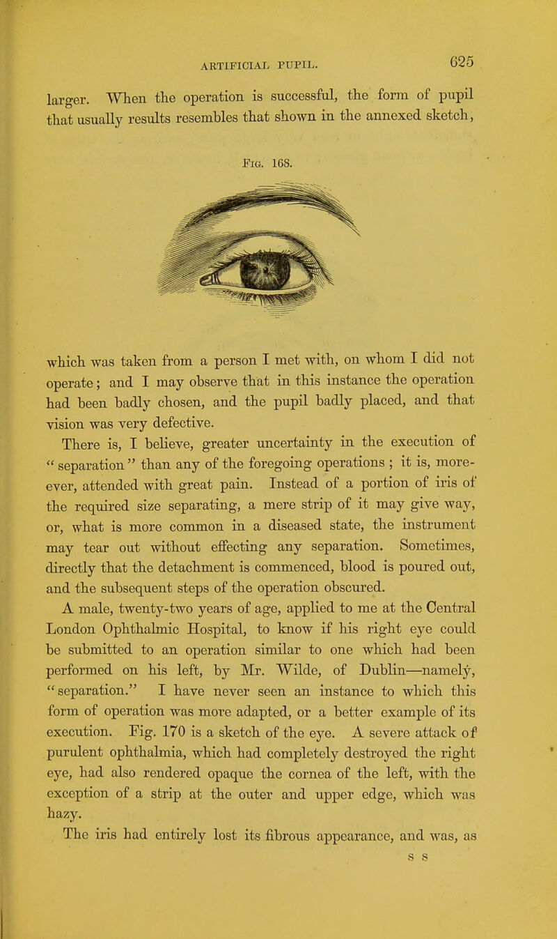 larger. When the operation is successful, the form of pupil that usually results resembles that shown in the annexed sketch, Fig. 168. which was taken from a person I met with, on whom I did not operate; and I may observe that in this instance the operation had been badly chosen, and the pupil badly placed, and that vision was very defective. There is, I believe, greater imcertainty in the execution of  separation  than any of the foregoing operations ; it is, more- over, attended with great pain. Instead of a portion of iris of the required size separating, a mere strip of it may give way, or, what is more common in a diseased state, the instrument may tear out without effecting any separation. Sometimes, directly that the detachment is commenced, blood is poured out, and the subsequent steps of the operation obscured. A male, twenty-two years of age, applied to me at the Central London Ophthalmic Hospital, to know if his right eye could be submitted to an operation similar to one which had been performed on his left, by Mr. Wilde, of Dublin—namely, separation. I have never seen an instance to which this form of operation was more adapted, or a better example of its execution. Pig. 170 is a sketch of the eye. A severe attack of purulent ophthalmia, which had completely destroyed the right eye, had also rendered opaque the cornea of the left, with the exception of a strip at the outer and upper edge, which was hazy. The iris had entirely lost its fibrous appearance, and was, as