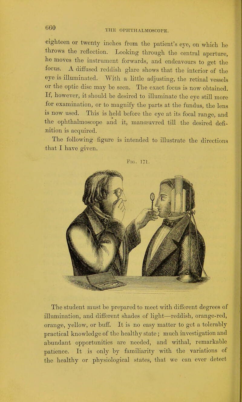 'I'lIK OPHTHALMOSCOPE. eighteen or twenty inches from the patient's eye, on which he throws the reflection. Looking through the central aperture, he moves the instrument forwards, and endeavours to get the focus. A diffused reddish glare shows that the interior of the eye is illuminated. With a little adjusting, the retinal vessels or the optic disc may be seen. The exact focus is now obtained. If, however, it should be desired to illuminate the eye stiU more for examination, or to magnify the parts at the fundus, the lens is now used. This is held before the eye at its focal range, and the ophthalmoscope and it, manoeuvred till the desired defi- nition is acquired. The following figm^e is intended to illustrate the directions that I have given. Fig. 171. The student must be prepared to meet with different degrees of illumination, and different shades of light—reddish, orange-red, orange, yellow, or buff. It is no easy matter to get a tolerably practical knowledge of the healthy state ; much investigation and abundant opportunities are needed, and withal, remarkable patience. It is only by familiarity with the variations of the healthy or physiological states, that we can ever detect