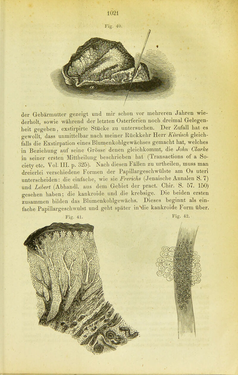 Fig. 4U. der Gebärmutter gezeigt und mir schon vor mehreren Jahren wie- derholt, sowie während der letzten Osterferien noch dreimal Gelegen- heit gegeben, exstirpirte Stücke zu untersuchen. Der Zufall hat es gewollt, dass unmittelbar nach meiner Rückkehr Herr Kiwisch gleich- falls die Exstirpation eines Blunienkohlgewächses gemacht hat, welches in Beziehung auf seine Grösse denen gleichkommt, die John Glarke in seiner ersten Mittheilung beschrieben hat (Transactions of a So- ciety etc. Vol. III. p. 325). Nach diesen Fällen zu urtheilen, muss man dreierlei verschiedene Formen der Papillargeschwülste am Os uteri unterscheiden: die einfache, wie Frerichs (Jenaische Annalen S. 7) und Lehert (Abhandl. aus dem Gebiet der pract. Chir. S. 57. 150) gesehen haben; die kankroide und die krebsige. Die beiden ersten zusammen bilden das Blumenkohlgewächs. Dieses beginnt als ein- fache Papillargeschwulst und geht später in*die kankroide Form über. Fig. 41. Fig. 42.