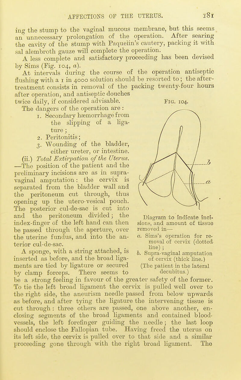 ino- the stump to the vaginal mucous membrane, but this seems an° unnecessary prolongation of the operation. After searing the cavity of the stump with Paqueiin's cautery, packing it with sal alembroth gauze will complete the operation. A less complete and satisfactory proceeding has been devised by Sims (Fig. 104, a). At intervals during the course of the operation antiseptic nushinff with a 1 in 4000 solution should be resorted to ; the after- treatment consists in removal of the packing twenty-four hours after operation, and antiseptic douches twice daily, if considered advisable. Fig. 104. The dangers of the operation are : 1. Secondary haemorrhage from the slipping of a liga- ture ; 2. Peritonitis; 3. Wounding of the bladder, either ureter, or intestine, (ii.) Total Extirpation of the Uterus. —The position of the patient and the preliminary incisions are as in supra- vaginal amputation: the cervix is separated from the bladder wall and the peritoneum cut through, thus opening up the utero-vesical pouch. The posterior cul-de-sac is cut into and the peritoneum divided; the index-finger of the left hand can then be passed through the aperture, over the uterine fundus, and into the an- terior cul-de-sac. A sponge, with a string attached, is inserted as before, and the broad liga- ments are tied by ligature or secured by clamp forceps. There seems to be a strong feeling in favour of the greater safety of the former. To tie the left broad ligament the cervix is pulled well over to the right side, the aneurism needle passed from below upwards as before, and after tying the ligature the intervening tissue is cut through : three others are passed, one above another, en- closing segments of the broad ligaments and contained blood- Diagram to indicate inci- sions, and amount of tissue removed in— a. Sims's operation for re- moval of cervix (dotted line) ; 6. Supra-vaginal amputation of cervix (thick line.) (The patient in the lateral decubitus.) vessels, the left forefinger guiding the needle the last loop should enclose the Fallopian tube. Having freed the uterus on its left side, the cervix is pulled over to that side and a similar proceeding gone through with the right broad ligament. The