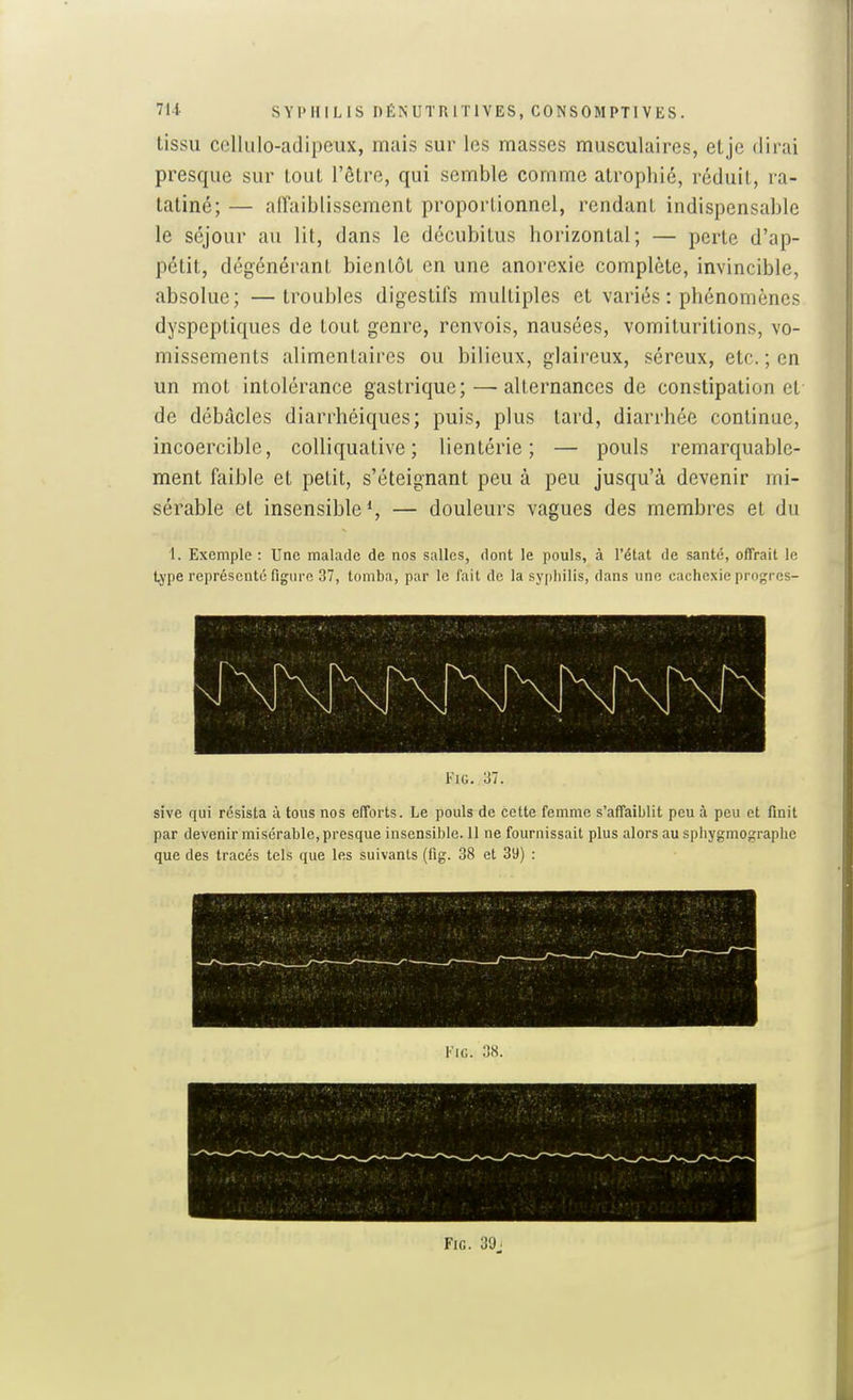 tissu ccllulo-adipeux, mais sur les masses musculaires, etje dirai presque sur tout l'êlre, qui semble comme atrophié, réduit, ra- tatiné; — affaiblissement proportionnel, rendant indispensable le séjour au lit, dans le décubitus horizontal; — perte d'ap- pétit, dégénérant bientôt en une anorexie complète, invincible, absolue; —troubles digestifs multiples et variés : phénomènes dyspeptiques de tout genre, renvois, nausées, vomituritions, vo- missements alimentaires ou bilieux, glaireux, séreux, etc. ; en un mot intolérance gastrique; — alternances de constipation et de débâcles diarrhéiques; puis, plus tard, diarrhée continue, incoercible, coUiquative ; lientérie ; — pouls remarquable- ment faible et petit, s'éteignant peu à peu jusqu'à devenir mi- sérable et insensible*, — douleurs vagues des membres et du 1. Exemple : Une malade de nos salles, dont le pouls, à Tétat de santé, offrait le type représenté figure 37, tomba, par le fait de la syphilis, dans une cachexie progres- i''iG. 37. sive qui résista à tous nos efforts. Le pouls de cette femme s'affaiblit peu à peu et finit par devenir misérable, presque insensible. 11 ne fournissait plus alors au sphygmographe que des tracés tels que les suivants (fig. 38 et 39) : FiG. 3'J