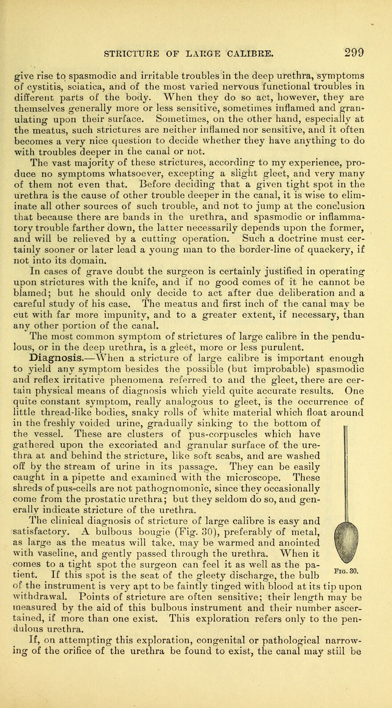give rise to spasmodic and irritable troubles in the deep urethra, symptoms of cystitis, sciatica, and of the most varied nervous functional troubles in different parts of the body. When they do so act, however, they are themselves generally more or less sensitive, sometimes inflamed and gran- ulating upon their surface. Sometimes, on the other hand, especially at the meatus, such strictures are neither inflamed nor sensitive, and it often becomes a very nice question to decide whether they have anything to do with troubles deeper in the canal or not. The vast majority of these strictures, according to my experience, pro- duce no symptoms whatsoever, excepting a sliglit gleet, and very many of them not even that. Before deciding that a given tight spot in the urethra is the cause of other trouble deeper in the canal, it is wise to elim- inate all other sources of such trouble, and not to jump at the conclusion that because there are bands in the urethra, and spasmodic or inflamma- tory trouble farther down, the latter necessarily depends upon the former, and will be relieved by a cutting operation. Such a doctrine must cer- tainly sooner or later lead a young man to the border-line of quackery, if not into its domain. In cases of grave doubt the surgeon is certainly justified in operating upon strictures with the knife, and if no good comes of it he cannot be blamed; but he should only decide to act after due deliberation and a careful study of his case. The meatus and first inch of the canal may be cut with far more impunity, and to a greater extent, if necessary, than any other portion of the canal. The most common symptom of strictures of large calibre in the pendu- lous, or in the deep urethra, is a gleet, more or less purulent. Diagnosis.—When a stricture of large calibre is important enough to yield any symptom besides the possible (but improbable) spasmodic and reflex irritative phenomena referred to and the gleet, there are cer- tain physical means of diagnosis which yield quite accurate results. One quite constant symptom, really analogous to gleet, is the occurrence of little thread-like bodies, snaky rolls of white material which float around in the freshly voided urine, gradually sinking to the bottom of the vessel. These are clusters of pus-corpuscles which have gathered upon the excoriated and granular surface of the ure- thra at and behind the stricture, like soft scabs, and are washed off by the stream of urine in its passage. They can be easily caught in a pipette and examined with the microscope. These shreds of pus-cells are not pathognomonic, since they occasionally come from the prostatic urethra; but they seldom do so, and gen- erally indicate stricture of the urethra. The clinical diagnosis of stricture of large calibre is easy and satisfactory. A bulbous bougie (Fig. 30), preferably of metal, as large as the meatus will take, may be warmed and anointed with vaseline, and gently passed through the urethra. When it comes to a tight spot the surgeon can feel it as well as the pa- tient. If this spot is the seat of the gleety discharge, the bulb of the instrument is very apt to be faintly tinged with blood at its tip upon withdrawal. Points of stricture are often sensitive; their length may be measured by the aid of this bulbous instrument and their number ascer- tained, if more than one exist. This exploration refers only to the pen- dulous urethra. If, on attempting this exploration, congenital or pathological narrow- ing of the orifice of the urethra be found to exist, the canal may still be