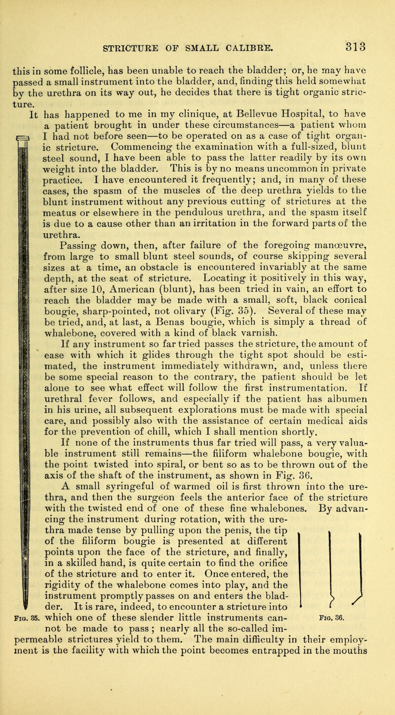 this in some follicle, has been unable to reach the bladder; or, he may have passed a small instrument into the bladder, and, finding this held somevvliat by the urethra on its way out, he decides that there is tight organic stric- ture. It has happened to me in my clinique, at Bellevue Hospital, to have a patient brought in under these circumstances—a patient v^'hom I had not before seen—to be operated on as a case of tight organ- ic stricture. Commencing the examination w^ith a full-sized, blunt steel sound, I have been able to pass the latter readily by its own weight into the bladder. This is by no means uncommon in private practice. I have encountered it frequently; and, in man}^ of these cases, the spasm of the muscles of the deep urethra yields to the blunt instrument without any previous cutting of strictures at the meatus or elsewhere in the pendulous urethra, and the spasm itself is due to a cause other than an irritation in the forward parts of the urethra. Passing down, then, after failure of the foregoing manoeuvre, from large to small blunt steel sounds, of course skipping several sizes at a time, an obstacle is encountered invariably at the same depth, at the seat of stricture. Locating it positively in this way, after size 10, American (blunt), has been tried in vain, an effort to reach the bladder may be made with a small, soft, black conical bougie, sharp-pointed, not olivary (Fig. 35). Several of these may be tried, and, at last, a Benas bougie, which is simply a thread of whalebone, covered with a kind of black varnish. If any instrument so far tried passes the stricture, the amount of ease with which it glides through the tight spot should be esti- mated, the instrument immediately withdrawn, and, unless there be some special reason to the contrary, the patient should be let alone to see what effect will follow the first instrumentation. If urethral fever follows, and especially if the patient has albumen in his urine, all subsequent explorations must be made with special care, and possibly also with the assistance of certain medical aids for the prevention of chill, which I shall mention shortly. If none of the instruments thus far tried will pass, a very valua- ble instrument still remains—the filiform whalebone bougie, with the point twisted into spiral, or bent so as to be thrown out of the axis of the shaft of the instrument, as shown in Fig. 36. A small syringeful of warmed oil is first thrown into the ure- thra, and then the surgeon feels the anterior face of the stricture with the twisted end of one of these fine whalebones. By advan- cing the instrument during rotation, with the ure- thra made tense by pulling upon the penis, the tip of the filiform bougie is presented at different points upon the face of the stricture, and finally, in a skilled hand, is quite certain to find the orifice of the stricture and to enter it. Once entered, the rigidity of the whalebone comes into play, and the instrument promptly passes on and enters the blad- der. It is rare, indeed, to encounter a stricture into Fig. 35. which one of these slender little instruments can- Fig. 36. not be made to pass ; nearly all the so-called im- permeable strictures yield to them. The main difficulty in their employ- ment is the facility with which the point becomes entrapped in the mouths
