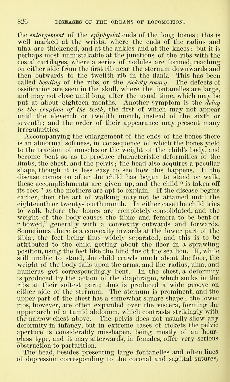the enlargement of the epiphysial ends of the long bones: this is well marked at the wrists, where the ends of the radius and ulna are thickened, and at the ankles and at the knees ; but it is perhaps most unmistakable at the junctions of the ribs with the costal cartilages, where a series of nodules are formed, reaching on either side from the first rib near the sternum downwards and then outwards to the twelfth rib in the flank. This has been called beading of the ribs, or the rickety rosary. The defects of ossification are seen in the skull, where the fontanelles are large, and may not close until long after the usual time, which may be put at about eighteen months. Another symptom is the delay in the eruption of the teeth, the first of which may not appear until the eleventh or twelfth month, instead of the sixth or seventh; and the order of their appearance may present many irregularities. Accompanying the enlargement of the ends of the bones there is an abnormal softness, in consequence of which the bones yield to the traction of muscles or the weight of the child's body, and become bent so as to produce characteristic deformities of the limbs, the chest, and the pelvis; the head also acquires a peculiar shape, though it is less easy to see how this happens. If the disease comes on after the child has begun to stand or walk, these accomplishments are given up, and the child  is taken off its feet as the mothers are apt to explain. If the disease begins earlier, then the art of walking may not be attained until the eighteenth or twenty-fourth month. In either case the child tries to walk before the bones are completely consolidated, and the weight of the body causes the tibiae and femora to be bent or  bowed, generally with a convexity outwards and forwards. Sometimes there is a convexity inwards at the lower part of the tibiae, the feet being thus widely separated, and this is to be attributed to the child getting about the floor in a sprawling position, using the feet like the hind fins of the sea lion. If, while still unable to stand, the child crawls much about the floor, the weight of the body falls upon the arms, and the radius, ulna, and humerus get correspondingly bent. In the chest, a deformity is produced by the action of the diaphragm, which sucks in the ribs at their softest part; thus is produced a wide groove on either side of the sternum. The sternum is prominent, and the upper part of the chest has a somewhat square shape ; the lower ribs, however, are often expanded over the viscera, forming the upper arch of a tumid abdomen, which contrasts strikingly with the narrow chest above. The pelvis does not usually show any deformity in infancy, but in extreme cases of rickets the pelvic aperture is considerably misshapen, being mostly of an hour- glass type, and it may afterwards, in females, offer very serious obstruction to parturition. The head, besides presenting large fontanelles and often lines of depression corresponding to the coronal and sagittal sutures.