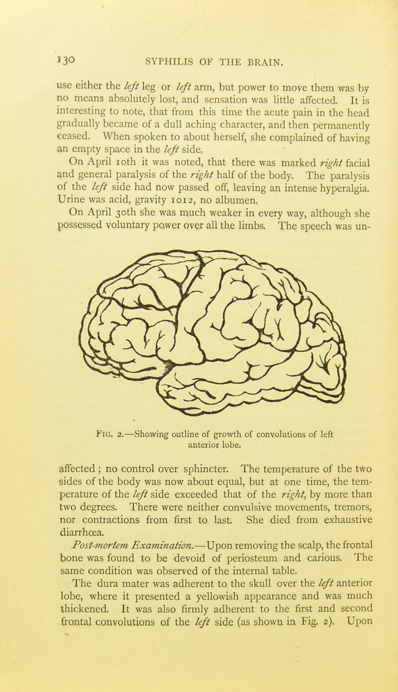 use either the left leg or left arm, but power to move them was by no means absolutely lost, and sensation was little affected. It is interesting to note, that from this time the acute pain in the head gradually became of a dull aching character, and then permanently eeased. When spoken to about herself, she complained of having »n empty space in the left side. On April loth it was noted, that there was marked right facial and general paralysis of the right half of the body. The paralysis of the left side had now passed off, leaving an intense hyperalgia. Urine was acid, gravity 1012, no albumen. On April 30th she was much weaker in every way, although she possessed voluntary power over all the limbs. The speech was un- FlG. 2.—Showing outline of growth of convolutions of left anterioi; lobe. affected; no control over sphincter. The temperature of the two sides of the body was now about equal, but at one time, the tem- perature of the left side exceeded that of the rights by more than two degrees. There were neither convulsive movements, tremors, nor contractions from first to. last. She died from exhaustive diarrhoea. Post-mortem Examination.—Upon removing the scalp, the frontal bone was found to be devoid of periosteum and carious. The same condition was observed of the internal table. The dura mater was adherent to the skull over the left anterior lobe, where it presented a yellowish appearance and was much thickened. It was also firmly adherent to the first and second frontal convolutions of the left side (as shown in Fig. 2). Upon