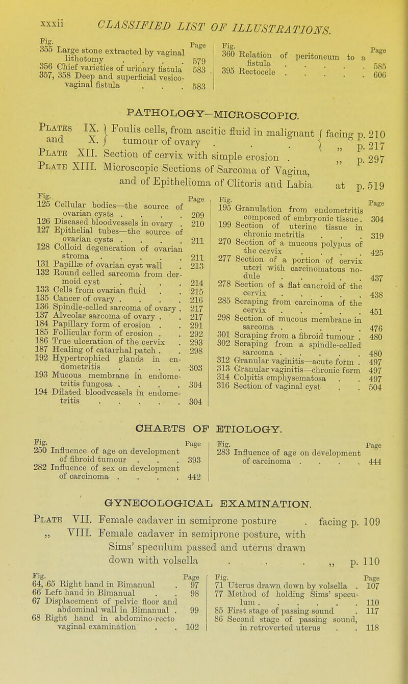 355 Large stone extracted by vaginal lithotomy • . . . 579 okI^ Chief varieties of urinary fistula 683 O07, 358 Deep and suijerficial vesico- vaginal fistula . . . 583 Fig. p ^ 360 Relation of peritoneum to a fistula ggr, 395 Rectocele • ■ . . 60(5 Plates and Plate PATHOLOGY-MICROSCOPIC. IX. ) Foulis cells, from ascitic fluid in malignant f facing p Plate XIII X. J tumom- of ovary XII. Section of cervix with simple erosion Microscopic Sections of Sarcoma of Vagina, and of Epithelioma of Clitoris and Labia 210 217 297 ^'S- Page 125 Cellular bodies—the soui-ce of ovarian cysts .... 209 126 Diseased bloodvessels in ovary . 210 127 Epithelial tubes—the source of ovarian cysts .... 211 128 Colloid degeneration of ovarian stroma 211 131 PapUlae of ovarian cyst wall . 213 132 Round celled sarcoma from der- moid cyst .... 214 133 Cells from ovarian fluid . . 215 135 Cancer of ovary .... 216 136 Spindle-celled sarcoma of ovary . 217 137 Alveolar sarcoma of ovary . . 217 184 PapiUary form of erosion . . 291 185 Follicular form of erosion . . 292 186 True ulceration of the cervix . 293 187 Healing of catarrhal patch . . 298 192 Hypertrophied glands in en- dometritis .... 303 193 Mucous membrane in endome- tritis fungosa . . . . 304 194 Dilated bloodvessels in endome- tritis 304 at p. 519 Fig- Page 195 Granulation from endometritis composed of embryonic tissue . 304 199 Section of uterine tissue in chronic metritis . . . 319 270 Section of a mucous polypus of the cervix .... 425 277 Section of a portion of cervix uteri with carcinomatous no- diile 43^ 278 Section of a flat cancroid of the cervix 433 285 Scraping from carcinoma of the cervix 45]^ 298 Section of mucous membrane in sarcoma 476 301 Scraping from a fibroid tumour . 480 302 Scraping from a spindle-ceUed sarcoma 450 312 Gramxlar vaginitis—acute form . 497 313 Granular vaginitis—chronic form 497 314 Colpitis emphysematosa . . 497 316 Section of vaginal cyst . . 504 Fig- Page 250 Influence of age on development of fibroid tumour . . . 393 282 Infiuence of sex on development of carcinoma .... 442 CHARTS OF ETIOLOGY. Pig. 283 Influence of age on development of carcinoma .... Page 444 GYNECOLOGICAL EXAMINATION. Plate VII. Female cadaver in semiprone posture . facing p. 109 VIII. Female cadaver in semiprone posture, with Sims' speculum passed and uterus drawn down with volsella . . . „ p. 110 Fig- Page 64, 65 Right hand in Bimanual . 97 66 Left hand in Bimanual . . 98 67 Displacement of pelvic floor and abdominal waU in Bimanual . 99 68 Right hand in abdomino-recto vaginal examination . . 102 Fig. Page 71 Uterus drawn down by volseUa . 107 77 Method of hokliug Sims' specu- lum 110 85 First stage of passing sound . 117 86 Second stage of passing sound, in retroverted uterus . . 118