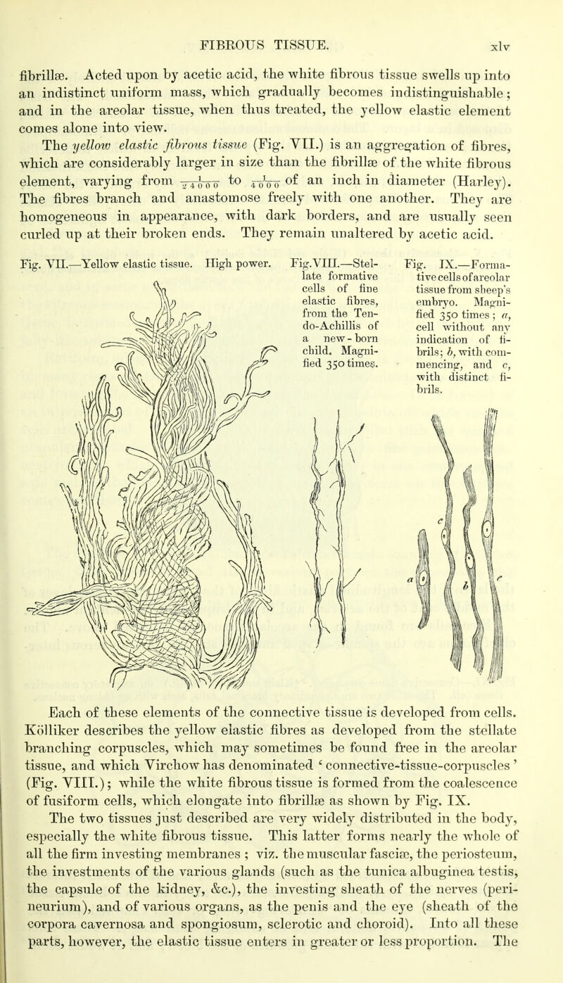 fibrillse. Acted upon by acetic acid, the white fibrous tissue swells up into an indistinct uniform mass, which gradually becomes indistinguishable; and in the areolar tissue, when thus treated, the yellow elastic element comes alone into view. The yellow elastic fibrous tissue (Fig. VII.) is an aggregation of fibres, which are considerably larger in size than the fibrillse of the white fibrous element, varying from ytoito to roVo °f an inch in diameter (Harley). The fibres branch and anastomose freely with one another. They are homogeneous in appearance, with dark borders, and are usually seen curled up at their broken ends. They remain unaltered by acetic acid. Fig-. VII.— Yellow elastic tissue. High power. Fig. VIII.—Stel- late formative cells of fine elastic fibres, from the Ten- do-Achillis of a new - born child. Magni- fied 350 times. Fig. IX.—Forma- tive cells of areolar tissue from sheep's embryo. Magni- fied 350 times ; a, cell without any indication of fi- brils ; b, with com- mencing, and c, ■with distinct fi- brils. Each of these elements of the connective tissue is developed from cells. Kolliker describes the yellow elastic fibres as developed from the stellate branching corpuscles, which may sometimes be found free in the areolar tissue, and which Virchow has denominated 6 connective-tissue-corpuscles ' (Fig. VIII.); while the white fibrous tissue is formed from the coalescence of fusiform cells, which elongate into fibrillse as shown by Fig. IX. The two tissues just described are very widely distributed in the body, especially the white fibrous tissue. This latter forms nearly the whole of all the firm investing membranes ; viz. the muscular fascia?, the periosteum, the investments of the various glands (such as the tunica albuginea testis, the capsule of the kidney, &c), the investing sheath of the nerves (peri- neurium), and of various organs, as the penis and the eye (sheath of the corpora cavernosa and spongiosum, sclerotic and choroid). Into all these parts, however, the elastic tissue enters in greater or less proportion. The