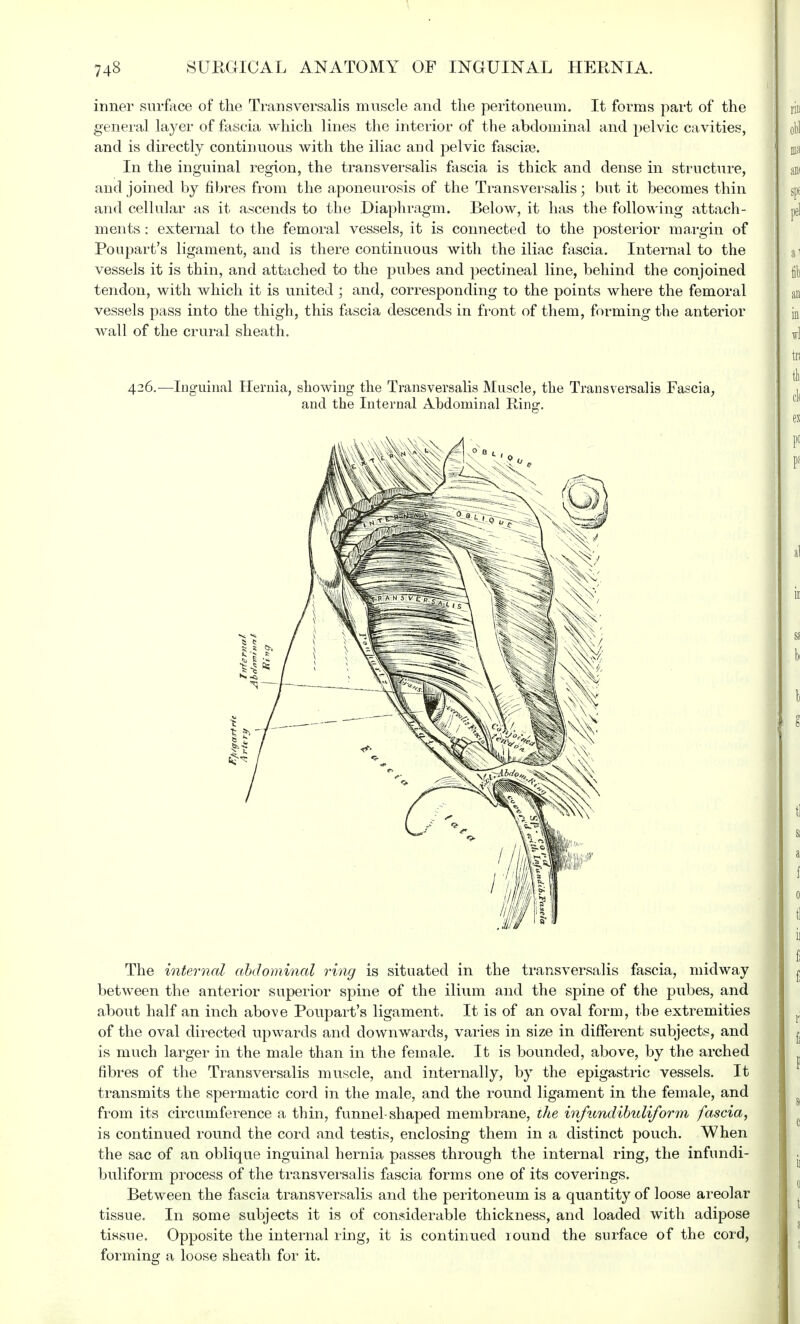 inner surface of the Transversalis muscle and the peritoneum. It forms part of the general layer of fascia which lines the interior of the abdominal and pelvic cavities, and is directly continuous with the iliac and pelvic fasciae. In the inguinal region, the transversalis fascia is thick and dense in structure, and joined by fibres from the aponeurosis of the Transversalis • but it becomes thin and cellular as it ascends to the Diaphragm. Below, it has the following attach- ments : external to the femoral vessels, it is connected to the posterior margin of Poupart's ligament, and is there continuous with the iliac fascia. Internal to the vessels it is thin, and attached to the pubes and pectineal line, behind the conjoined tendon, with which it is united ; and, corresponding to the points where the femoral vessels pass into the thigh, this fascia descends in front of them, forming the anterior wall of the crural sheath. 426.—Inguinal Hernia, showing the Transversalis Muscle, the Transversalis Fascia, and the Internal Abdominal Ring. The internal abdominal ring is situated in the transversalis fascia, midway between the anterior superior spine of the ilium and the spine of the pubes, and about half an inch above Poupart's ligament. It is of an oval form, the extremities of the oval directed upwards and downwards, varies in size in different subjects, and is much larger in the male than in the female. It is bounded, above, by the arched fibres of the Transversalis muscle, and internally, by the epigastric vessels. It transmits the spermatic cord in the male, and the round ligament in the female, and from its circumference a thin, funnel-shaped membrane, the infundibuliform fascia, is continued round the cord and testis, enclosing them in a distinct pouch. When the sac of an oblique inguinal hernia passes through the internal ring, the infundi- buliform process of the transversalis fascia forms one of its coverings. Between the fascia transversalis and the peritoneum is a quantity of loose areolar tissue. In some subjects it is of considerable thickness, and loaded with adipose tissue. Opposite the internal ring, it is continued round the surface of the cord, forming a loose sheath for it,