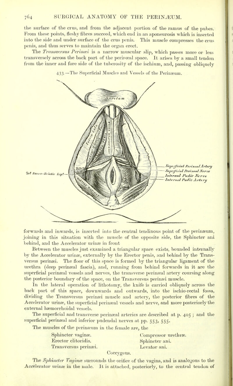 the surface of the crus, and from the adjacent portion of the ramus of the pubes. From these points, fleshy fibres succeed, which end in an aponeurosis which is inserted into the side and under surface of the crus penis. This muscle compresses the crus penis, and thus serves to maintain the organ erect. The Transversus Perincei is a narrow muscular slip, which passes more or less transversely across the back part of the perinseal space. It arises by a small tendon from the inner and fore side of the tuberosity of the ischium, and, passing obliquely 433.—The Superficial Muscles and Vessels of the Perinseum. forwards and inwards, is inserted into the central tendinous point of the perinseum, joining in this situation with the muscle of the opposite side, the Sphincter ani behind, and the Accelerator urinas in front Between the muscles just examined a triangular space exists, bounded internally by the Accelerator urinse, externally by the Erector penis, and behind by the Trans- versus perinsei. The floor of this space is formed by the triangular ligament of the urethra (deep perineal fascia), and, running from behind forwards in it are the superficial perinseal vessels and nerves, the transverse perineal artery coursing along the posterior boundary of the space, on the Transversus perinsei muscle. In the lateral operation of lithotomy, the knife is carried obliquely across the back part of this space, downwards and outwards, into the ischio-rectal fossa, dividing the Transversus perinsei muscle and artery, the posterior fibres of the Accelerator urines, the superficial perinseal vessels and nerve, and more posteriorly the external hemorrhoidal vessels. The superficial and transverse perinseal arteries are described at p. 405 ; and the superficial perinseal and inferior pudendal nerves at pp. 553, 555. The muscles of the perinseum in the female are, the Sphincter vaginse. Compressor urethras. Erector clitoridis. Sphincter ani. Transversus perinsei. Levator ani. Coccygeus. The Sphincter Vagince surrounds the orifice of the vagina, and is analogous to the Accelerator urinse in the male. It is attached, posteriorly, to the central tendon of