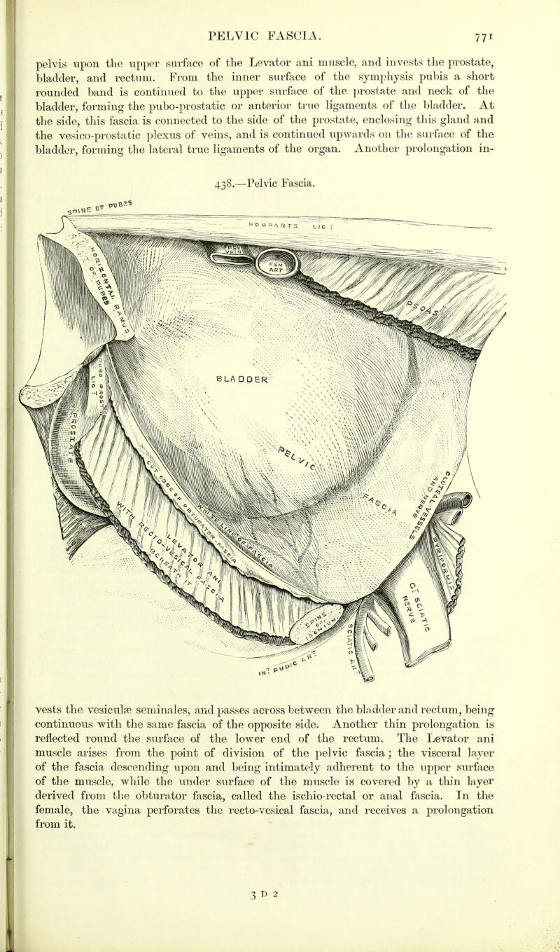 pelvis upon the upper surface of the Levator ani muscle, and invests the prostate, bladder, and rectum. From the inner surface of the symphysis pubis a short rounded band is continued to the upper surface of the prostate and neck of the bladder, forming the pubo-prostatic or anterior true ligaments of the bladder. At the side, this fascia is connected to the side of the prostate, enclosing this gland and the vesico-prostatic plexus of veins, and is continued upwards on the surface of the bladder, forming the lateral true ligaments of the organ. Another prolongation in- 438.—Pelvic Fascia. vests the vesiculse seminales, and passes across between the bladder and rectum, being continuous with the same fascia of the opposite side. Another thin prolongation is reflected round the surface of the lower end of the rectum. The Levator ani muscle arises from the point of division of the pelvic fascia; the visceral layer of the fascia descending upon and being intimately adherent to the upper surface of the muscle, while the under surface of the muscle is covered by a thin layer derived from the obturator fascia, called the ischio-rectal or anal fascia. In the female, the vagina perforates the recto-vesical fascia, and receives a prolongation from it. 3 d 2