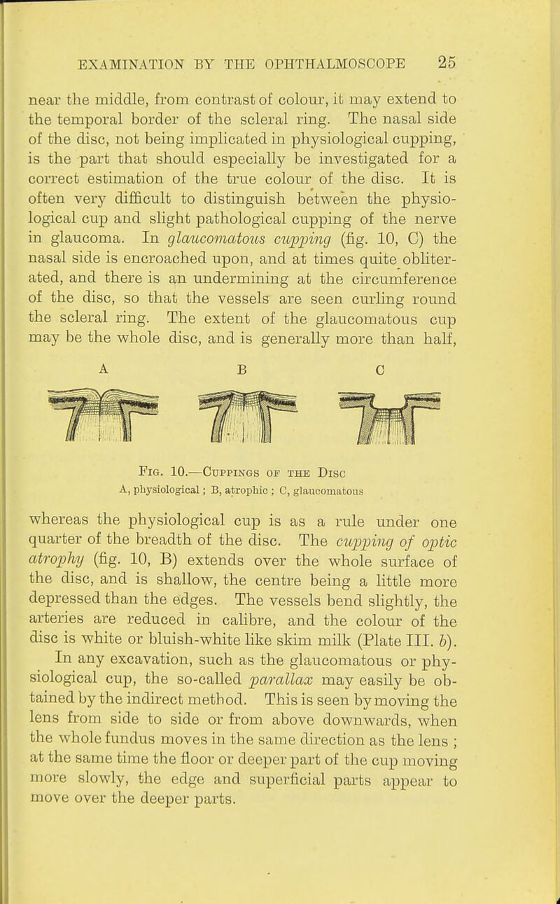 near the middle, from contrast of colour, it may extend to the temporal border of the scleral ring. The nasal side of the disc, not being implicated in physiological cupping, is the part that should especially be investigated for a correct estimation of the true colour of the disc. It is often very difficult to distinguish between the physio- logical cup and slight pathological cupping of the nerve in glaucoma. In glaucomatous clipping (fig. 10, C) the nasal side is encroached upon, and at times quite obliter- ated, and there is an undermining at the circumference of the disc, so that the vessels are seen curling round the scleral ring. The extent of the glaucomatous cup may be the whole disc, and is generally more than half, ABC Fig. 10.—Cuppings of the Disc A, physiological; B, atrophic ; C, glaucomatous whereas the physiological cup is as a rule under one quarter of the breadth of the disc. The cupping of optic atrophy (fig. 10, B) extends over the whole surface of the disc, and is shallow, the centre being a little more depressed than the edges. The vessels bend sHghtly, the arteries are reduced in caHbre, and the colour of the disc is white or bluish-white Hke skim milk (Plate III. b). In any excavation, such as the glaucomatous or phy- siological cup, the so-called parallax may easily be ob- tained by the indirect method. This is seen by moving the lens from side to side or from above downwards, when the whole fundus moves in the same direction as the lens ; at the same time the floor or deeper part of the cup moving more slowly, the edge and superficial parts appear to move over the deeper parts.