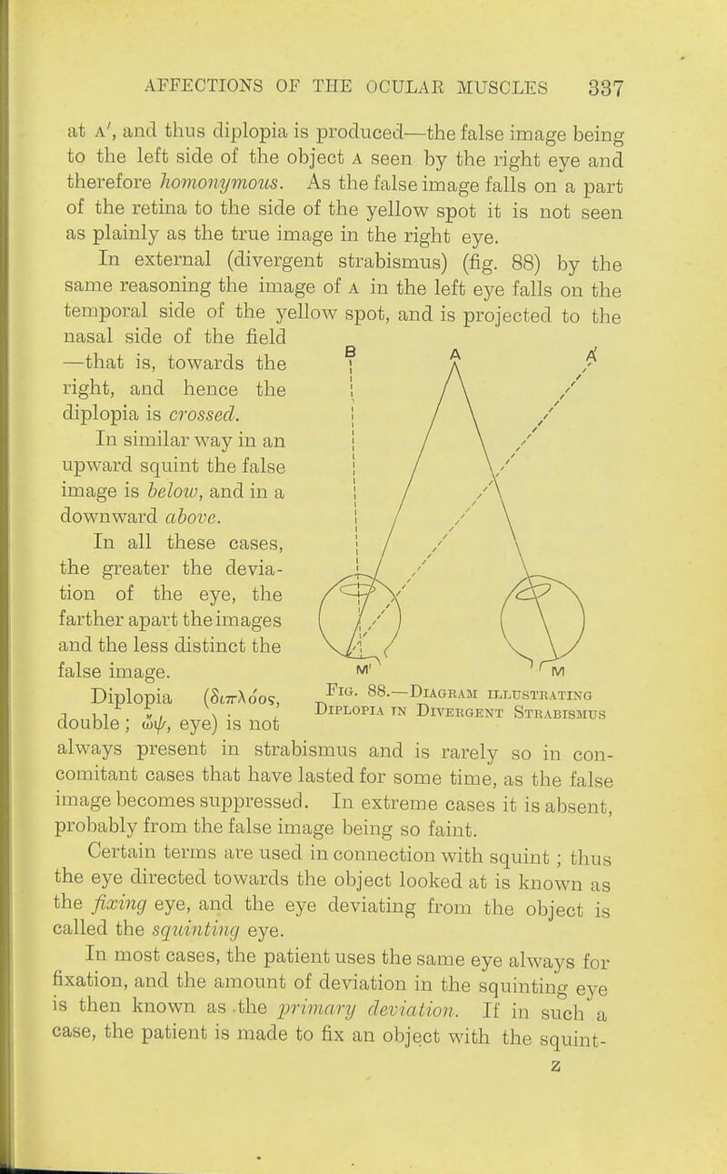 at a', and thus diplopia is produced—the false image being to the left side of the object A seen by the right eye and therefore hovionymous. As the false image falls on a part of the retina to the side of the yellow spot it is not seen as plainly as the true image in the right eye. In external (divergent strabismus) (fig. 88) by the same reasoning the image of a in the left eye falls on the temporal side of the yellow spot, and is projected to the nasal side of the field —that is, towards the • ■ - right, and hence the diplopia is crossed. In similar way in an upward squint the false image is heloio, and in a downward above. In all these cases, the greater the devia- tion of the eye, the farther apart the images and the less distinct the false image. Diplopia (S67rXoos, double ; wi//-, eye) is not always present in strabismus and is rarely so in con- comitant cases that have lasted for some time, as the false image becomes suppressed. In extreme cases it is absent, probably from the false image being so faint. Certain terms are used in connection with squint ; thus the eye directed towards the object looked at is known as the fixing eye, and the eye deviating from the object is called the squinting eye. In most cases, the patient uses the same eye always for fixation, and the amount of deviation in the squinting eye is then known as .the primary deviation. If in such a case, the patient is made to fix an object with the squint- Fig. 88.—Diagram iiiLusTEATiNo Diplopia in Divergent Strabismus