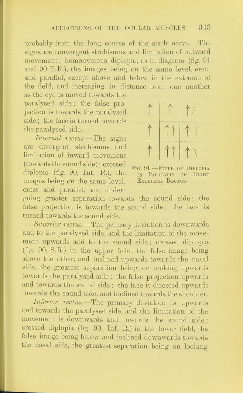 t t t t tT Fig. 91.—Field of Diplopia IN Pakalysis of Eight External Eectus probably from the long course of the sixth nerve. The signs are convergent strabismus and limitation of outward movement; homonymous diplopia, as in diagram (fig. 91 and 90 E.E.), the images being on the same level, erect and parallel, except above and below in the extreme of the field, and increasing in distance from one another as the eye is moved towards the paralysed side; the false pro- jection is towards the paralysed side ; the face is turned towards the paralysed side. Internal rectus.—The signs are divergent strabismus and limitation of inward movement (towards the sound side); crossed diplopia (fig. 90, Int. E.), the images being on the same level, erect and parallel, and under- going greater separation towards the sound side; the false projection is towards the sound side ; the face is turned towards the sound side. Superior rectus.—The primary deviation is downwards and to the paralysed side, and the limitation of the move- ment upwards and to the sound side; crossed diplopia (fig. 90, S.E.) in the upper field, the false image being above the other, and inclined upwards towards the nasal side, the greatest separation being on looking upwards towards the paralysed side ; the false projection upwards and towards the sound side; the face is directed upwards towards the sound side, and inclined towards the shoulder. Inferior rectus.—The primary deviation is upwards and towards the paralysed side, and the Hmitation of the movement is downwards and towards the sound side; crossed diplopia (fig. 90, Inf. E.) in the lower field, the false image being below and inclined downwards towards the nasal side, the greatest separation being on looking