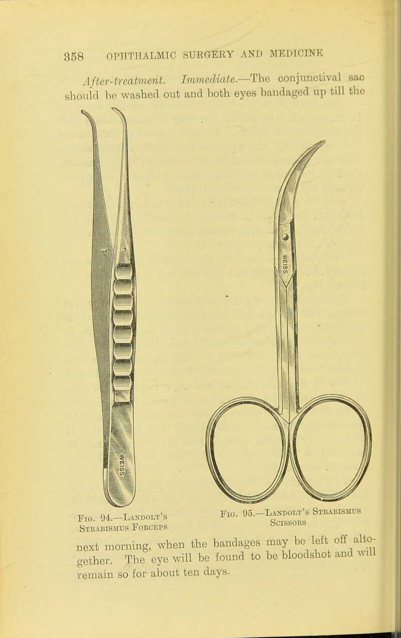 After-treatment. Immediate—The conjunctival sac should be washed out and both eyes bandaged up till the Fig. 94.—Landolt's Stbabismus Fokceps 95—Landolt's Strabismus Scissons next morning, when the bandages may be left off alto- gether. Tbe eye will be found to be bloodshot and wUl remain so for about ten days.