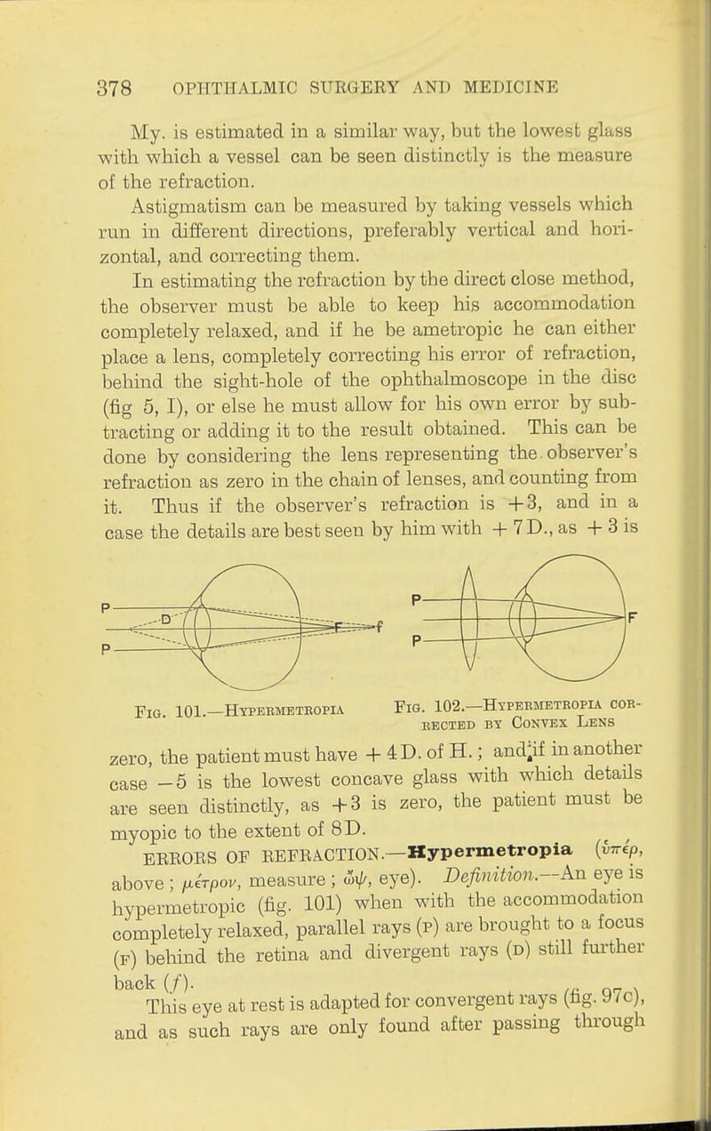 My. is estimated in a similar way, but the lowest glass with which a vessel can be seen distinctly is the measure of the refraction. Astigmatism can be measured by taking vessels which run in different directions, preferably vertical and hori- zontal, and correcting them. In estimating the refraction by the direct close method, the observer must be able to keep his accommodation completely relaxed, and if he be ametropic he can either place a lens, completely correcting his error of refraction, behind the sight-hole of the ophthalmoscope in the disc (fig 5, I), or else he must allow for his own error by sub- tracting or adding it to the result obtained. This can be done by considering the lens representing the.observer's refraction as zero in the chain of lenses, and counting from it. Thus if the observer's refraction is -f 3, and in a case the details are best seen by him with -1- 7D., as +S is Fig. 101.—Htpbrmeteopia Fig. 102.—Hypeemeteopia coe- EECTED BY CoNVEX LeNS zero, the patient must have + 4D. of H.; and^if in another case -5 is the lowest concave glass with which detaUs are seen distinctly, as -f 3 is zero, the patient must be myopic to the extent of 8D. ERRORS OF REFRACTION.—Kypermetropia {iirip, above ; i^erpov, measure ; ^ij^, eye). Definition.-An eye is hypermetropic (fig. 101) when with the accommodation completely relaxed, parallel rays (p) are brought to a focus (f) behind the retina and divergent rays (d) still further back if). fr. nn \ This eye at rest is adapted for convergent rays (fag. 97c), and as such rays are only found after passing through