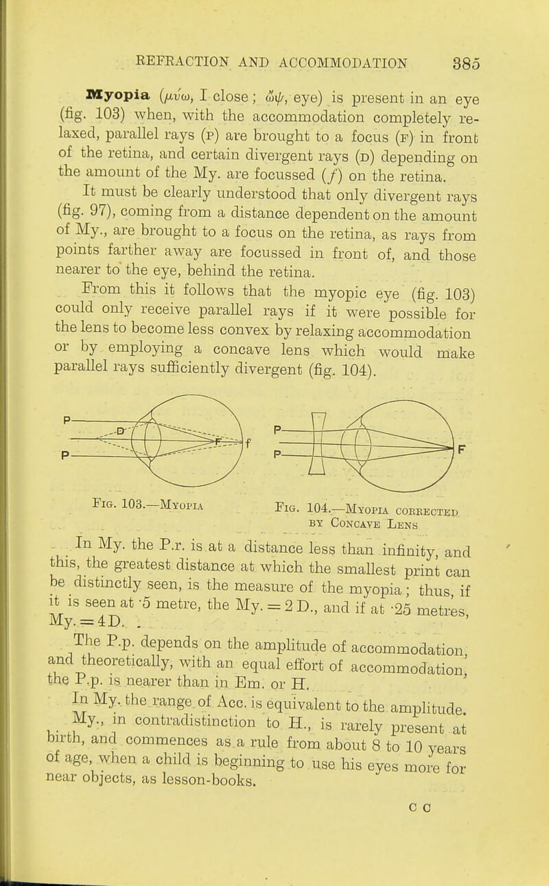 Myopia {fiv(^, I close; ^ij/, eye) is present in an eye (fig. 103) when, with the accommodation completely re- laxed, parallel rays (p) are brought to a focus (f) in front of the retina, and certain divergent rays (d) depending on the amount of the My. are focussed (/) on the retina. It must be clearly understood that only divergent rays (fig. 97), coming from a distance dependent on the amount of My., are brought to a focus on the retina, as rays from points farther away are focussed in front of, and those nearer to' the eye, behind the retina. , From this it follows that the myopic eye (fig. 103) could only receive parallel rays if it were possible for the lens to become less convex by relaxing accommodation or by employing a concave lens which would make parallel rays sufficiently divergent (fig. 104). p- p- Fig. 103.-MYOPIA Fig. 104.-Myopia coeeected BY Concave Lens In My. the P.r. is.at a distance less than infinity, and this, the greatest distance at which the smaUest print can be distinctly seen, is the measure of the myopia • thus if It IS seen at 5 metre, the My. = 2 D., and if at -25 metres My. = 4D. . The P.p. depends on the ampHtude of accommodation and theoretically, with an equal effort of accommodation' the P.p. IS nearer than in Em. or H. ' In My. the range, of Acc. is equivalent to the amplitude My., m contradistinction to H., is rarely present at birth, and commences as.a rule from about 8 to 10 years of age, when a child is beginning to use his eyes more for near objects, as lesson-books. c 0