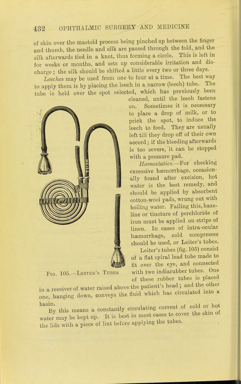 of skin over the mastoid process being pinched up between the finger and thumb, the needle and silk are passed through the fold, and the silk afterwards tied in a knot, thus forming a circle. This is left in for weeks or months, and sets up considerable irritation and dis- charge ; the silk should be shifted a little every two or three days. Leeches may be used from one to four at a time. The best way to apply them is by placing the leech in a narrow (leech) tube. The tube is held over the spot selected, which has previously been cleaned, until the leech fastens on. Sometimes it is necessary to place a drop of milk, or to prick the spot, to mduce the leech to feed. They are usually left till they drop off of their own accord; if the bleeding afterwards is too severe, it can be stopped with a pressure pad. HcBvwstatica.—'For checking excessive hemorrhage, occasion- ally found after excision, hot water is the best remedy, and should be applied by absorbent cotton-wool pads, wrung out with boiling water. Failing this, haze- line or tincture of perchloride of iron must be applied on strips of linen. In cases of intra-ocular hEemorrhage, cold compresses should be used, or Leiter's tubes. Leiter's tubes (fig. 105) consist of a flat spiral lead tube made to tit over the eye, and connected with two indiarubber tubes. One of these rubber tubes is placed in a receiver of water raised above the patient's head; and the other one, hanging down, conveys the fluid which has circulated mto a 'b; this means a constantly circulating current of cold or hot watei may be kept up. It is best in most cases to cover the skm of the lids with a piece of lint before applying the tubes. Fig. 105. -Lbitee's Tubes