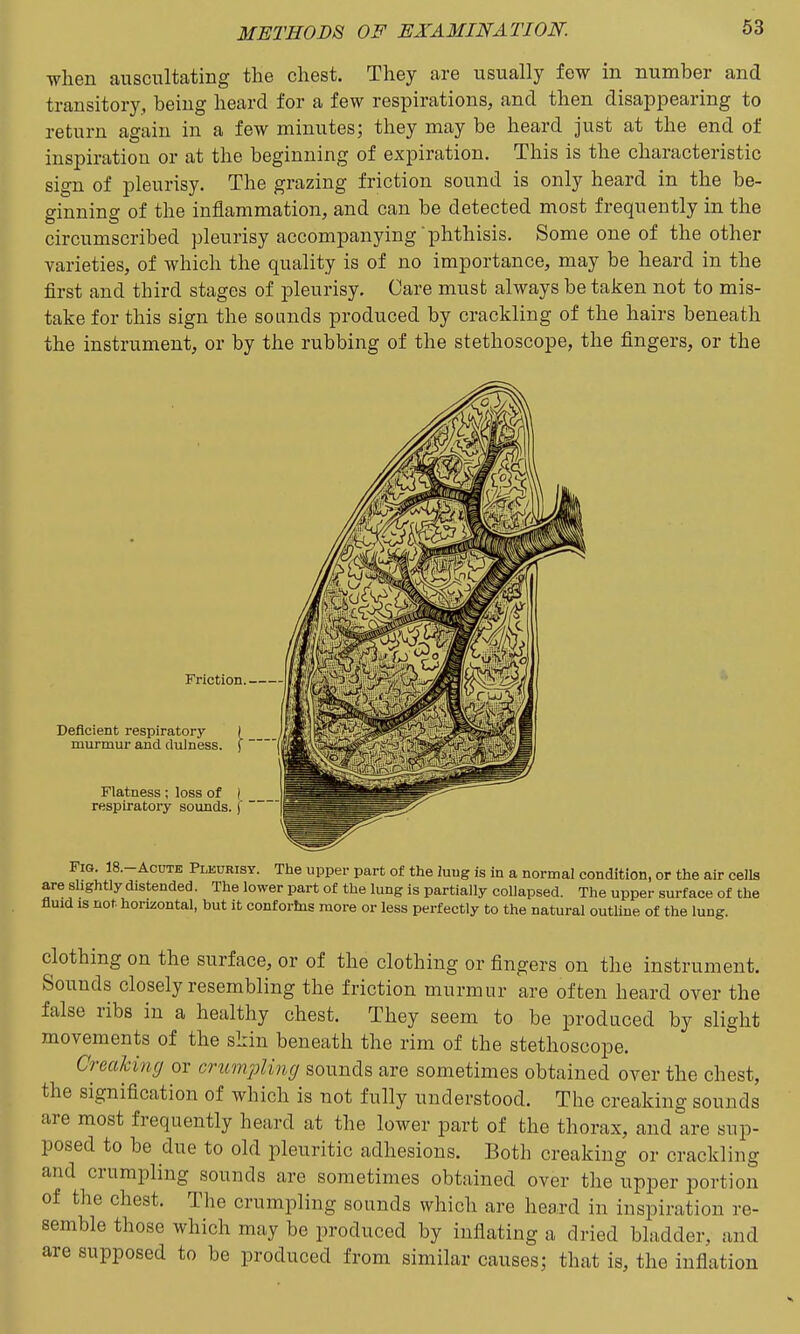 when auscultating the chest. They are usually few in number and transitory, being heard for a few respirations, and then disappearing to return again in a few minutes; they may be heard just at the end of inspiration or at the beginning of expiration. This is the characteristic sign of pleurisy. The grazing friction sound is only heard in the be- ginning of the inflammation, and can be detected most frequently in the circumscribed pleurisy accompanying phthisis. Some one of the other varieties, of which the quality is of no importance, may be heard in the first and third stages of pleurisy. Care must always be taken not to mis- take for this sign the sounds produced by crackling of the hairs beneath the instrument, or by the rubbing of the stethoscope, the fingers, or the Friction ; Deficient respiratory | murmur and dulness. ( ' Flatness; loss of respiratory sounds. Fig. 18.-ACUTE Pleurisy. The upper part of the lung is in a normal condition, or the air cells are shghtly distended. The lower part of the lung is partially collapsed. The upper surface of the fluid IS not horizontal, but it confortns more or less perfectly to the natural outUne of the lung. clothing on the surface, or of the clothing or fingers on the instrument. Sounds closely resembling the friction murmur are often heard over the false ribs in a healthy chest. They seem to be produced by slight movements of the skin beneath the rim of the stethoscope. Creaking or crumpling sounds are sometimes obtained over the chest, the signification of which is not fully understood. The creaking sounds are most frequently heard at the lower part of the thorax, and are sup- posed to be due to old pleuritic adhesions. Both creaking or crackling and crumpling sounds are sometimes obtained over the upper portion of the chest. The crumpling sounds which are heard in inspiration re- semble those which may be produced by inflating a dried bladder, and are supposed to be produced from similar causes; that is, the inflation