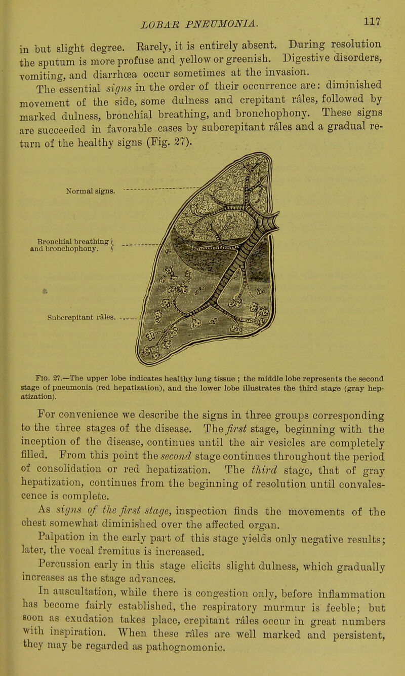 in but slight degree. Earely, it is entirely absent. During resolution the sputum is more profuse and yellow or greenish. Digestive disorders, vomiting, and diarrhoea occur sometimes at the invasion. The essential signs in the order of their occurrence are: diminished movement of the side, some dulness and crepitant rales, followed by marked dulness, bronchial breathing, and bronchophony. These signs are succeeded in favorable cases by subcrepitant rales and a gradual re- turn of the healthy signs (Fig. 27). Fig. 27.—The upper lobe indicates healthy lung tissue ; the middle lobe represents the second stage of pneumonia (red hepatization), and the lower lobe iUustrates the third stage (gray hep- atization). For convenience we describe the signs in three groups corresponding to the three stages of the disease. TIYiq first stage, beginning with the inception of the disease, continues until the air vesicles are completely filled. From this point the second stage continues throughout the period of consolidation or red hepatization. The third stage, that of gray hepatization, continues from the beginning of resolution until convales- cence is complete. As signs of the first stage, inspection finds the movements of the chest somewhat diminished over the affected organ. Palpation in the early part of this stage yields only negative results; later, the vocal fremitus is increased. Percussion early in this stage elicits slight dulness, which gradually increases as the stage advances. In auscultation, while there is congestion only, before inflammation has become fairly established, the respiratory murmur is feeble; but soon as exudation takes place, crepitant rales occur in great numbers with inspiration. When these rdles are well marked and persistent, they may be regarded as pathognomonic.