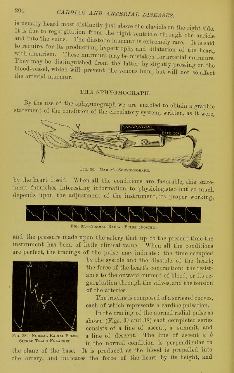 IS usually heard most distinctly just above the clavicle on the right side It IS due to regurgitation from the right ventricle through the auricle and into the veins. The diastolic murmur is extremely ilre. It is said to require, for its production, hypertrophy and dilatation of the heart with aneurism These murmurs may be mistaken for arterial murmurs' They may be distinguished from the latter by slightly pressing on the blood-vessel, which will prevent the venous hum, but will not so affect the arterial murmur. THE SPHYGMOGRAPH. By the use of the sphygmograph we are enabled to obtain a graphic statement of the condition of the circulatory system, written, as it were. Fig. 3G.—Marey's Sphygmograph. by the heart itself. When all the conditions are favorable, this state- ment furnishes interesting information to physiologists,- but so much depends upon the adjustment of the instrument, its proper working, Fig. 37.—Normal Radial Pulse (Foster), and the pressure made upon the artery that up to the present time the instrument has been of little clinical value. When all the conditions are perfect, the tracings of the pulse may indicate: the time occupied by the systole and the diastole of the heart; the force of the heart's contraction; the resist- ance to the onward current of blood, or its re- gurgitation through the valves, and the tension of the arteries. Thetracing is composed of a series of curves, each of which represents a cardiac pulsation. In the tracing of the normal radial pulse as shown (Figs. 37 and 38) each completed series consists of a line of ascent, a summit, and Fig. 38.—Normal Radial Pulse, a line of descent. The line of ascent a b Single Trace fnlarged. ^j^^ normal condition is perpendicular to the plane of the base. It is produced as the blood is propelled into the artery, and indicates the force of the heart by its height, and