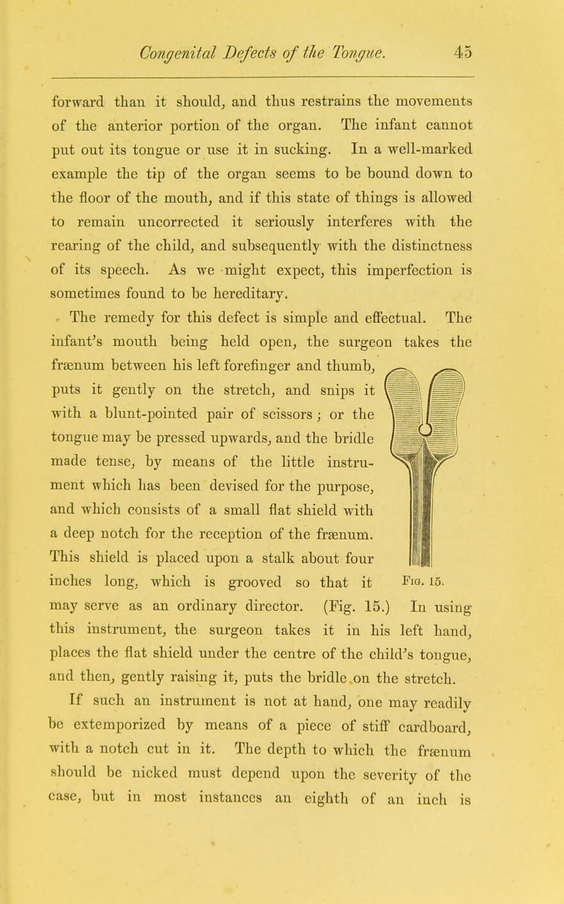 forward than it sLould^ and thus restrains the movements of the anterior portion of the organ. The infant cannot put out its tongue or use it in sucking. In a well-marked example the tip of the organ seems to be bound down to the floor of the mouth, and if this state of things is allowed to remain uncorrected it seriously interferes with the rearing of the child, and subsequently with the distinctness of its speech. As we might expect, this imperfection is sometimes found to be hereditary. . The remedy for this defect is simple and effectual. The infant's mouth being held open, the surgeon takes the frsenum between his left forefinger and thumb, puts it gently on the stretch, and snips it with a blunt-pointed pair of scissors ; or the tongue may be pressed upwards, and the bridle made tense, by means of the little instru- ment which lias been devised for the purpose, and which consists of a small flat shield with a deep notch for the reception of the frsenum. This shield is placed upon a stalk about four iuches long, which is grooved so that it Fig- 15- may serve as an ordinary director. (Fig. 15.) In using this instrument, the surgeon takes it in his left hand, places the flat shield under the centre of the child's tongue, and then, gently raising it, puts the bridle .on the stretch. If such an instrument is not at hand, one may readily be extemporized by means of a piece of stiflF cardboard, with a notch cut in it. The depth to which the fr^num should be nicked must depend upon the severity of the case, but in most instances an eighth of an inch is