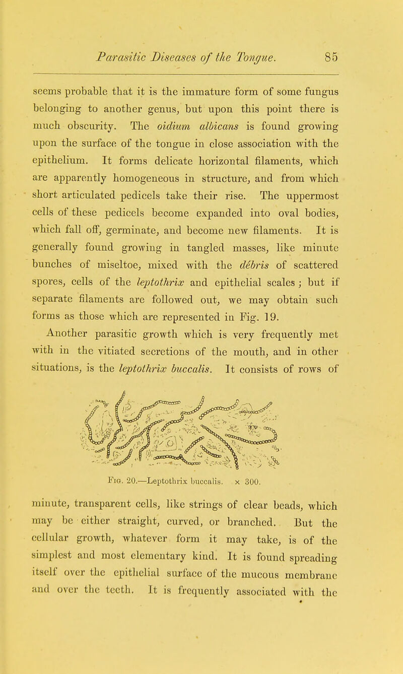 seems pi-obable that it is the immature form of some fungus belonging to another genus, but upon this point there is much obscurity. The oidium albicans is found growing upon the surface of the tongue in close association with the epithelium. It forms delicate horizontal filaments, which are apparently homogeneous in structure, and from which short articulated pedicels take their rise. The uppermost cells of these pedicels become expanded into oval bodies, which fall oflT, germinate, and become new filaments. It is generally found growing in tangled masses, like minute bunches of miseltoe, mixed with the debris of scattered spores, cells of the leptothrios and epithelial scales ; but if separate filaments are followed out, we may obtain such foi'ms as those which are represented in Fig. 19. Another parasitic growth which is very frequently met with in the vitiated secretions of the mouth, and in other situations, is the leptotlirix buccalis. It consists of rows of Fig. 20.—Leptotlirix buccalis. x 300. minute, transparent cells, like strings of clear beads, which may be either straight, curved, or branched. But the cellular growth, whatever form it may take, is of the simplest and most elementary kind. It is found spreading itself over the epithelial surface of the mucous membrane and over the teeth. It is frequently associated with the