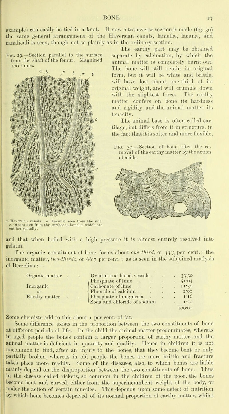 Fig. 29.—Section parallel to the surface from the shaft of the femur. Magnified 100 times. example) can easily be tied, in a knot. If now a transverse section is made (fig. 30) the same general arrangement of the Haversian canals, lamells^, lacunae, and canaliculi is seen, though not so plainly as in the ordinary section. The earthy part may be obtained separate by calcination, by which the animal matter is completely burnt out. The bone will still retain its original form, but it will be white and brittle, will have lost about one-third of its original weight, and will crumble down with the slightest force. The earthy matter confers on bone its hardness and rigidity, and the animal matter its tenacity. The animal base is often called car- tilage, but differs from it in structure, in the fact that it is softer and more flexible, Fig. 30.—Section of bone after the re- moval of the earthy matter by the action of acids. a. Haversian canals, b. Lacunge seen from the side, c. Others seen from the surface in hvmellfe which are cut horizontally, and that when boiled with a high pressure it is almost entirely resolved into gelatin. The organic constituent of bone forms about one-third, or 33-3 per cent.; the inorganic matter, tifo-thirds, or 667 percent. ; as is seen in the subjoined analysis of Berzelius :— Oro^anic matter , Inorganic or Earthy matter Some chemists add to this about i per cent, of fat. Some difference exists in the proportion between the two constituents of bone at different periods of life. In the child the animal matter predominates, whereas in aged people the bones contain a larger proportion of earthy matter, and the animal matter is deficient in quantity and quality. Hence in children it is not uncommon to find, after an injury to the bones, that they become bent or only partially broken, whereas in old people the bones are more brittle and fracture takes place more readily. Some of the diseases, also, to which bones are liable mainly depend on the disproportion between the two constituents of bone. Thus in the disease called rickets, so common in the children of the poor, the bones become bent and curved, either from the superincumbent weight of the body, or under the action of certain muscles. This depends upon some defect of nutrition by which bone becomes deprived of its normal proportion of earthy matter, whilst Gelatin and blood-vessels. . 33-30 Phosphate of lime • 51-04 Carbonate of lime . 11-30 Fluoride of calcium . 2-00 Phosphate of magnesia Soda and chloride of sodium i-i6 r2o 100*00
