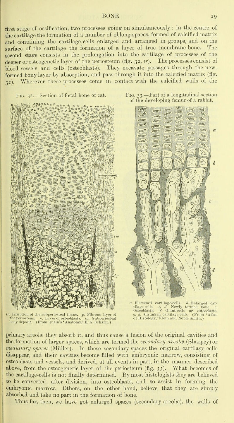 first stage of ossification, two processes going on simultaneously: in the centre of the cartilage the formation of a number of oblong spaces, formed of calcified matrix and containing the cartilage-cells enlarged and arranged in groups, and on the surface of the cartilage the formation of a layer of true membrane-bone. The second stage consists in the prolongation into the cartilage of processes of the deeper or osteogenetic layer of the periosteum (fig. 32, ir). The processes consist of blood-vessels and cells (osteoblasts). They excavate passages through the new- formed bony layer by absorption, and pass through it into the calcified matrix (fig. 32). Wherever these processes come in contact with the calcified walls of the YiQ. 32.—Section of foetal bone of cat. Fig. 33.—Part of a longitudinal section of the developing femur of a rabbit. if. Irruption of the subperiosteal tissue, p. Fibrous layer of g, h. Shrunken cartilage-cells. (Prom 'Atlas, the periosteum, o. Layer of osteoblasts, i;?;. Subperiosteal of Histology,'Klein and Noble Smith.) bony deposit. (From Quain's 'Anatomy,' E. A. Scluifer.) primary areolae they absorb it, and thus cause a fusion of the original cavities and the formation of larger spaces, which are termed the secondary areolce (Sharpey) or medullary sijaces (Mliller). In these secondary spaces the original cartilage-cells disappear, and their cavities become filled with embryonic marrow, consisting of osteoblasts and vessels, and derived, at all events in part, in the manner described above, from the osteogenetic layer of the periosteum (fig. 33). What becomes of the cartilage-cells is not finally determined. By most histologists they are believed to be converted, after division, into osteoblasts, and so assist in forming the embryonic marrow. Others, on the other hand, believe that they are simply absorbed and take no part in the formation of bone. Thus far, then, we have got enlarged spaces (secondary areolae), the walls of