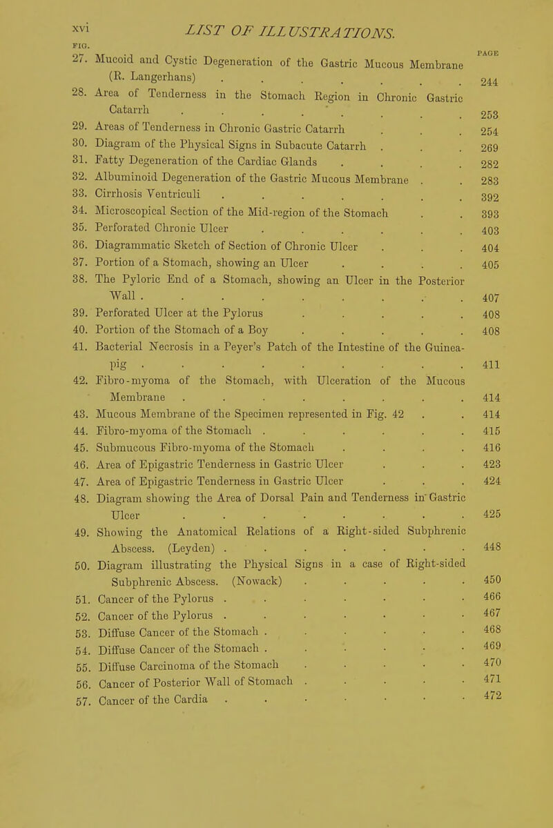 FIO. 27. Mucoid and Cystic Degeneration of the Gastric Mucous Membrane (R. Langorlians) 244 28. Area of Tenderness in the Stomach Region in Chronic Gastric Catarrh . . . . ' _ 253 29. Areas of Tenderness in Chronic Gastric Catarrh . . 254 30. Diagram of the Physical Signs in Subacute Catarrh . . .269 31. Fatty Degeneration of the Cardiac Glands .... 282 32. Albuminoid Degeneration of the Gastric Mucous Membrane . . 283 33. Cirrhosis Ventriculi ....... 392 34. Microscopical Section of the Mid-region of the Stomach . . 393 35. Perforated Chronic Ulcer ...... 403 36. Diagrammatic Sketch of Section of Chronic Ulcer . . . 404 37. Portion of a Stomach, showing an Ulcer .... 405 38. The Pyloric End of a Stomach, showing an Ulcer in the Posterior Wall ■ . 407 39. Perforated Ulcer at the Pylorus ..... 408 40. Portion of the Stomach of a Boy ..... 408 41. Bacterial Necrosis in a Peyer's Patch of the Intestine of the Guinea- pig . . . . . . . . .411 42. Fibro-myoma of the Stomach, with Ulceration of the Mucous Membrane ........ 414 43. Mucous Membrane of the Specimen represented in Fig. 42 . . 414 44. Fibro-myoma of the Stomach . . . . . .415 45. Submucous Fibro-myoma of the Stomach .... 416 46. Area of Epigastric Tenderness in Gastric Ulcer . . . 423 47. Area of Epigastric Tenderness in Gastric Ulcer . . . 424 48. Diagram showing the Area of Dorsal Pain and Tenderness in Gastric Ulcer ........ 425 49. Showing the Anatomical Relations of a Right-sided Subjihrenic Abscess. (Leyden) ....... 448 50. Diagram illustrating the Physical Signs in a case of Right-sided Subphrenic Abscess. (Nowack) ..... 450 51. Cancer of the Pylorus ....... 466 52. Cancer of the Pylorus 467 53. Diffuse Cancer of the Stomach ...... 468 54. Diffuse Cancer of the Stomach 469 55. Diffuse Carcinoma of the Stomach . . ■ • .470 56. Cancer of Posterior Wall of Stomach . . . • .471 57. Cancer of the Cardia 472