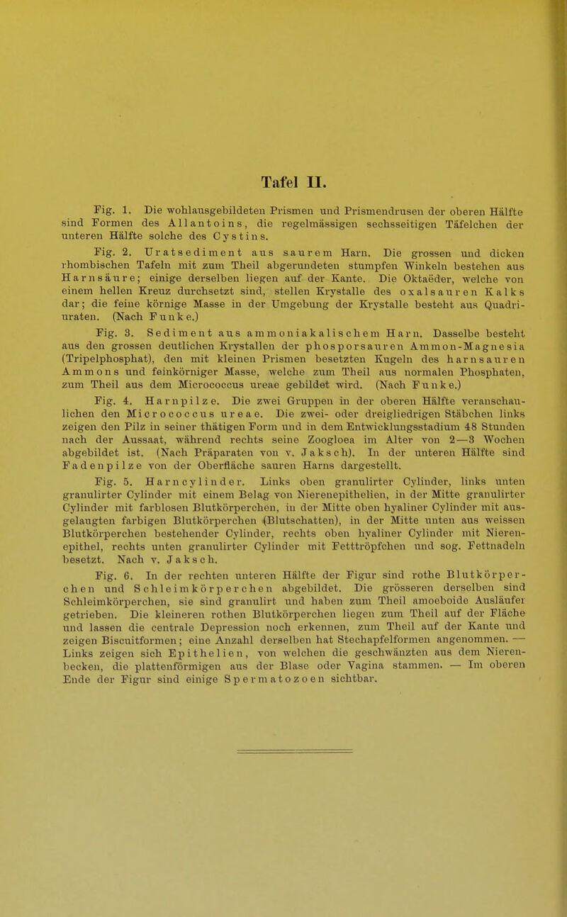 Fig. 1. Die wohlausgebildeten Prismen und Prismendrusen der oberen Hallte sind Formen des Allantoins, die regelmässigen sechsseitigen Täfelchen der unteren Hälfte solche des C y s t i n s. Fig. 2. Uratsediment aus saurem Harn. Die grossen und dicken rhombischen Tafeln mit zum Theil abgerundeten stumpfen Winkeln bestehen aus Harnsäure; einige derselben liegen auf der Kante. Die Oktaeder, welche von einem hellen Kreuz durchsetzt sind, stellen Krystalle des Oxalsäuren Kalks dar; die feine körnige Masse in der Umgebung der Krystalle besteht aus Quadri- uraten. (Nach Funk e.) Fig. 3. Sediment aus ammoniakalischem Harn. Dasselbe besteht aus den grossen deutlichen Krystallen der phosporsauren Ammon-Magnesia (Tripelphosphat), den mit kleinen Prismen besetzten Kugeln des harn sauren Ammons und feinkörniger Masse, welche zum Theil aus normalen Phosphaten, zum Theil aus dem Micrococcus ureae gebildet wird. (Nach Funke.) Fig. 4. Harnpilze. Die zwei Gruppen in der oberen Hälfte veranschau- lichen den Micrococcus ureae. Die zwei- oder dreigliedrigen Stäbchen links zeigen den Pilz in seiner thätigen Form und in dem Entwicklungsstadium 48 Stunden nach der Aussaat, während rechts seine Zoogloea im Alter von 2—8 Wochen abgebildet ist. (Nach Präparaten von v. Jaksch). In der unteren Hälfte sind Fadenpilze von der Oberfläche sauren Harns dargestellt. Fig. 5. H a r n c y 1 i n d e r. Links oben granulirter Cylinder, links unten granulirter Cylinder mit einem Belag von Nierenepithelien, in der Mitte granulirter Cylinder mit farblosen Blutkörperchen, in der Mitte oben hyaliner Cylinder mit aus- gelaugten farbigen Blutkörperchen (Blutschatten), in der Mitte unten aus weissen Blutkörperchen bestehender Cylinder, rechts oben hyaliner Cylinder mit Nieren- epithel, rechts unten granulirter Cylinder mit Fetttröpfchen und sog. Fettnadeln besetzt. Nach v. Jaksch. Fig. 6. In der rechten unteren Hälfte der Figur sind rothe Blutkörper- chen und Schleimkörperchen abgebildet. Die grösseren derselben sind Schleimkörperchen, sie sind grantüirt und haben zum Theil amoeboide Ausläufer getrieben. Die kleineren rothen Blutkörperchen liegen zum Theil auf der Fläche und lassen die centrale Depression noch erkennen, zum Theil auf der Kante und zeigen Biscuitformen; eine Anzahl derselben hat Stechapfelformen angenommen. — Links zeigen sich Epithelien, von welchen die geschwänzten aus dem Nieren- becken, die plattenförmigen aus der Blase oder Vagina stammen. — Im oberen Ende der Figur sind einige Spermatozoon sichtbar.