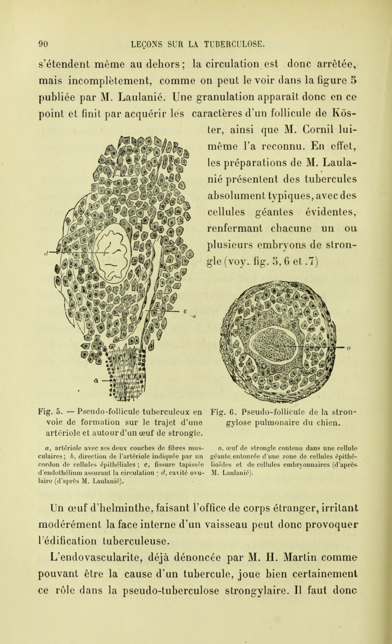 s'étendent même au dehors; la circulation est donc arrêtée, mais incomplètement, comme on peut le voir dans la figure 5 publiée par M. Laulanié. Une granulation apparaît donc en ce point et finit par acquérir les caractères d'un follicule de Kos- ter, ainsi que M. Cornil lui- même l'a reconnu. En effet, les préparations de M. Laula- nié présentent des tubercules absolument typiques, avec des cellules géantes évidentes, renfermant chacune un ou plusieurs embryons de stron- gle (voy. fig. 5, 6 et .7) Fig. 5. —Pseudo-follicule tuberculeux en Fig. G. Pseudo-follicule de la stron- voie de formation sur le trajet d'une gylose pulmonaire du chien, artériole et autourd'un œuf de stronglc. a, artériole avec ses deux couches de fibres mus- o, œuf de strongle contenu dans une cellule- culaires; 6, direction de l'artériole indiquée par un géante entourée d une zone de cellules épitlié- cordon de cellules épithéliales ; c, fissure tapissée lioïdes et de cellules embryonnaires (d'après, d'endothélium assurant la circulation • r/, cav ité ovu- M. Laulanié). laire (d'après M. Laulanié). Un œuf d'helminthe, faisant l'office de corps étranger, irritant modérément la face interne d'un vaisseau peut donc provoquer l'édification tuberculeuse. L'endovascularite, déjà dénoncée par M. H. Martin comme pouvant être la cause d'un tubercule, joue bien certainement ce rôle dans la pseudo-tuberculose strongylaire. Il faut donc