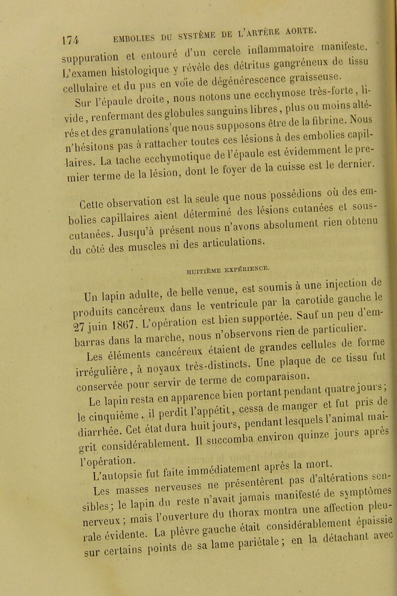 . .A ,1'nn oprcle inllammaloire rnanifesle. ^^^^^^^ Ceuc observation est la seule que nous possédions où des em- du côté des muscles ni des arliculations. HUITIÈME EXPÉRIENCE. barras dans la mai Mie, nou» „,,,„rtps cellules de forme Les éléments caueéreu. f V^^, ''^nu de ce tissu fut irré»ulière, à nopus très-disfucls. Une plaque 'cël^ervée ^our servir de terme de -JJ- • f™!';. fut faite immédiatement après la mort. Uautopsie fut laite imu . ^ g d'altérations scii- Les masses J '^ manifesté de svmptomes ,„es; le lap-;^' » affection pieu- nerveux ; - ^ ' !':„„,he était considérablement épaissie ;:r:;r PO^ salame pariétale; en la détaxant avec