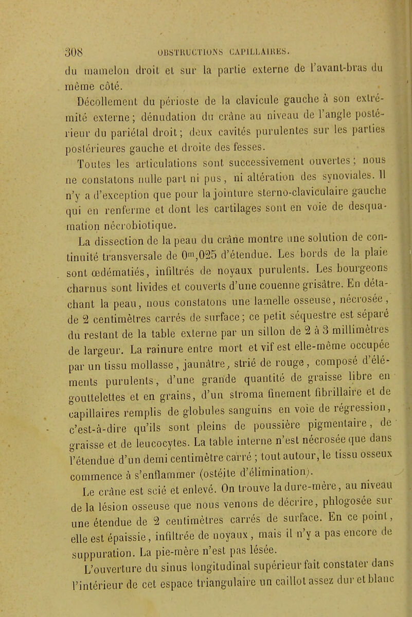 du mamelon droit el sui- la partie externe de l'avant-bras du même côté. Décollement du périoste de la clavicule gauche à son extré- mité externe; dénudation du crâne au niveau de l'angle posté- rieur du pariétal droit; doux cavités purulentes sur les parties posléi'ieures gauche et droite des fesses. Toutes les articulations sont successivement ouvertes; nous ne constatons nulle part ni pus, ni altération des synoviales. 11 n'y a d'exception que pour la jointure sterno-claviculaire gauche qui en renferme et dont les cartilages sont en voie de desqua- mation nécrobiotique. La dissection de la peau du crâne montre une solution de con- tinuité transversale de 0^,025 d'étendue. Les bords de la plaie sont œdématiés, infiltrés de noyaux purulents. Les bourgeons charnus sont livides et couverts d'une couenne grisâtre. En déta- chant la peau, nous constatons une lamelle osseuse, nécrosée, de 2 centimètres carrés de surface ; ce petit séquestre est séparé du restant de la table externe par un sillon de 2 à 3 millimètres de largeur. La rainure entre mort et vif est elle-même occupée par un tissu mollasse, jaunâtre, strié de rouge, composé d'élé- ments purulents, d'une grande quantité de graisse libre en gouttelettes et en grains, d'un stroma finement fibrillaire et de capillaires remplis de globules sanguins en voie de régression, c'est-à-dire qu'ils sont pleins de poussière pigmentaire, de ■ graisse et de leucocytes. La table interne n'est nécrosée que dans l'étendue d'un demi centimètre carré ; tout autour, le tissu osseux commence à s'enflammer (ostéite d'élimination). Le crâne est scié et enlevé. On trouve la dure-mère, au niveau de la lésion osseuse que nous venons de décrire, phlogosée sur une étendue de 2 centimètres carrés de surface. En ce point, elle est épaissie, infiltrée de noyaux , mais il n'y a pas encore de suppuration. La pie-mère n'est pas lésée. L'ouverture du sinus longitudinal supérieur fait constater dans l'intérieur de cet espace triangulaire un caillot assez dur et blanc