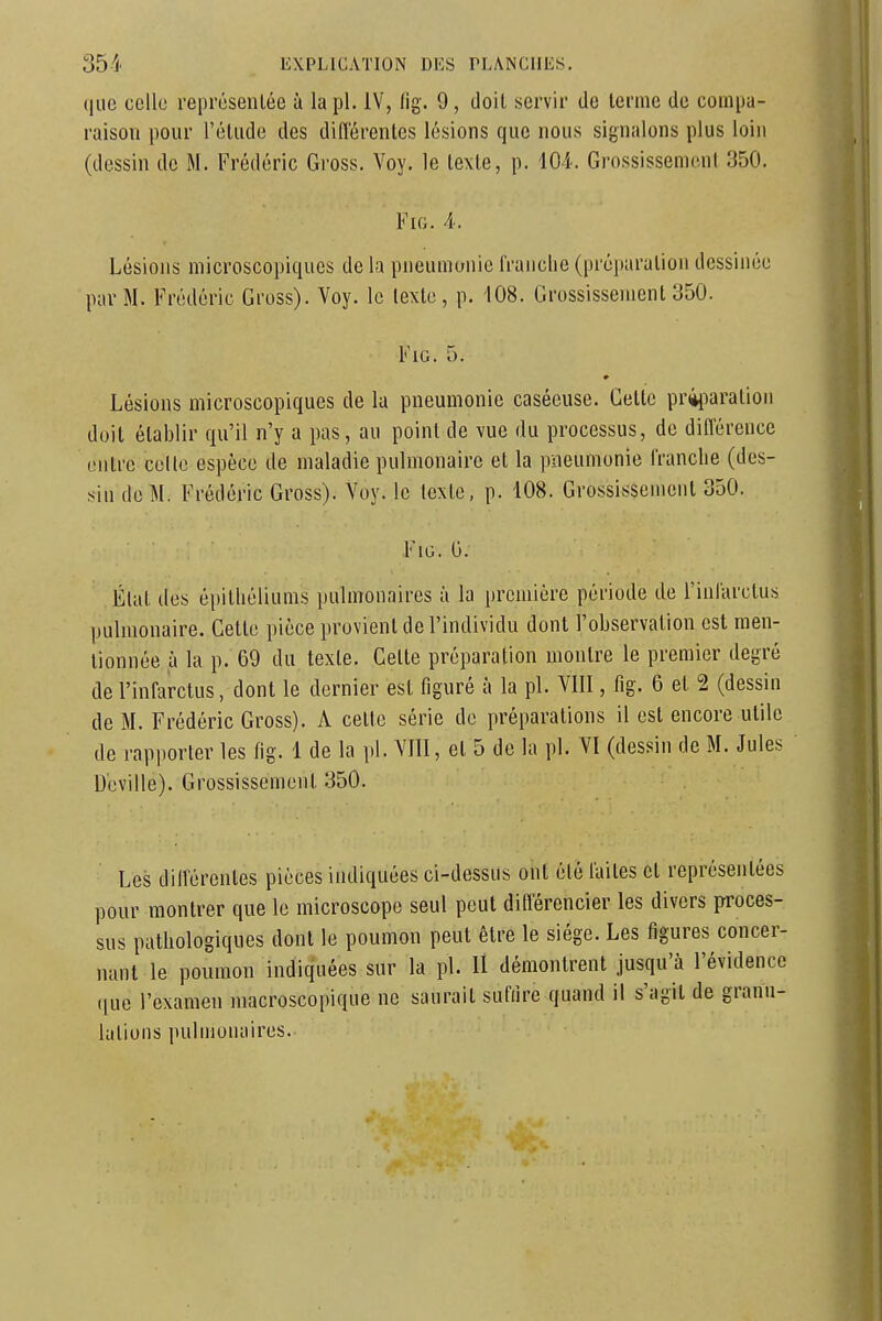 (|iic ccllu représentée à la pl. IV, fig. 9, doit servir de terme de compa- raison pour réliide des différentes lésions que nous signalons plus loin (dessin de M. Frédéric Gross. Voy. le texte, p. lO-i. Grossissement 350. F10. 4. Lésions microscopiques delà pneumonie franche (préparation dessinée par M. Frédéric Gross). Voy. le texte, p. 108. Grossissement 350. FiG. 5. Lésions microscopiques de la pneumonie caséeuse. Cette priiiaration doit établir qu'il n'y a pas, au point de vue du processus, de diflerence entre celle espèce de maladie pulmonaire et la pneumonie franche (des- sin de M. Frédéric Gross). Voy. le texte, p. 108. Grossissement 350. FiG. 0. État des épithéliums pulmonaires à la première période de l'inlarclus pulmonaire. Cette pièce provient de l'individu dont l'observation est men- tionnée h la p. 69 du texte. Cette préparation montre le premier degré de l'infarctus, dont le dernier est figuré à la pl. VIII, fig. 6 et 2 (dessin de M. Frédéric Gross). A celte série de préparations il est encore utile de rapporter les (ig. 1 de la pl. YIII, et 5 de la pl. VI (dessin de M. Jules D'cville). Grossissement 350. Les dilfércntes pièces indiquées ci-dessus ont été laites et représentées pour montrer que le microscope seul peut différencier les divers proces- sus pathologiques dont le poumon peut être le siège. Les figures concer- nant le poumon indiquées sur la pl. Il démontrent jusqu'à l'évidence (lue l'examen macroscopique ne saurait sufiire quand il s'agit de granu- lations pulmonaires.