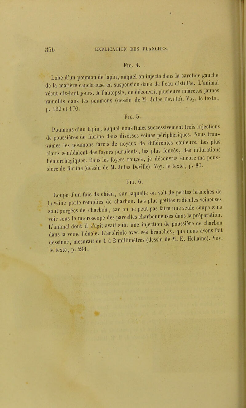 FiG. A. Lobe d'un poumon de lapin, auquel on injecla dans la carolido gauche de la malière cancéreuse en suspension dans de l'oau distillée. L'animal vécut dix-huit jours. A l'autopsie, on découvrit plusieurs infarctus jaunes ramollis dans les poumons (dessin de M. Jules Deville). Voy. le texte, p. 169 et 170. FiG. 5. Poumons d'un lapin, auquel nous fîmes successivement trois injections de poussières de fibrine dans diverses veines périphériques. Nous trou- vâmes les poumons farcis de noyaux de différentes couleurs. Les plus clairs semblaient des foyers purulents;, les plus foncés, des indurations hémorrhagiques. Dans les foyers rouges, je découvris encore ma pous- sière de fibrine (dessin de M. Jules Deville). Voy. le texte, p. 80. FiG. 6. Coupe d'un foie de chien, sur laquelle on voit de petites branches de la veine porte remplies de charbon. Les plus petites radicules veineuses sont gorgées de charbon , car on ne peut pas faire une seule coupe sans voir sous le microscope des parcelles charbonneuses dans la préparation. L'animal dont il s'agit avait subi une injection de poussière de charbon dans la veine liénale. L'artériole avec ses branches, que nous avons fait dessiner, mesurait de 1 à 2 millimètres (dessiu de M. E. Hellaine). \oy. le texte, p. 241.