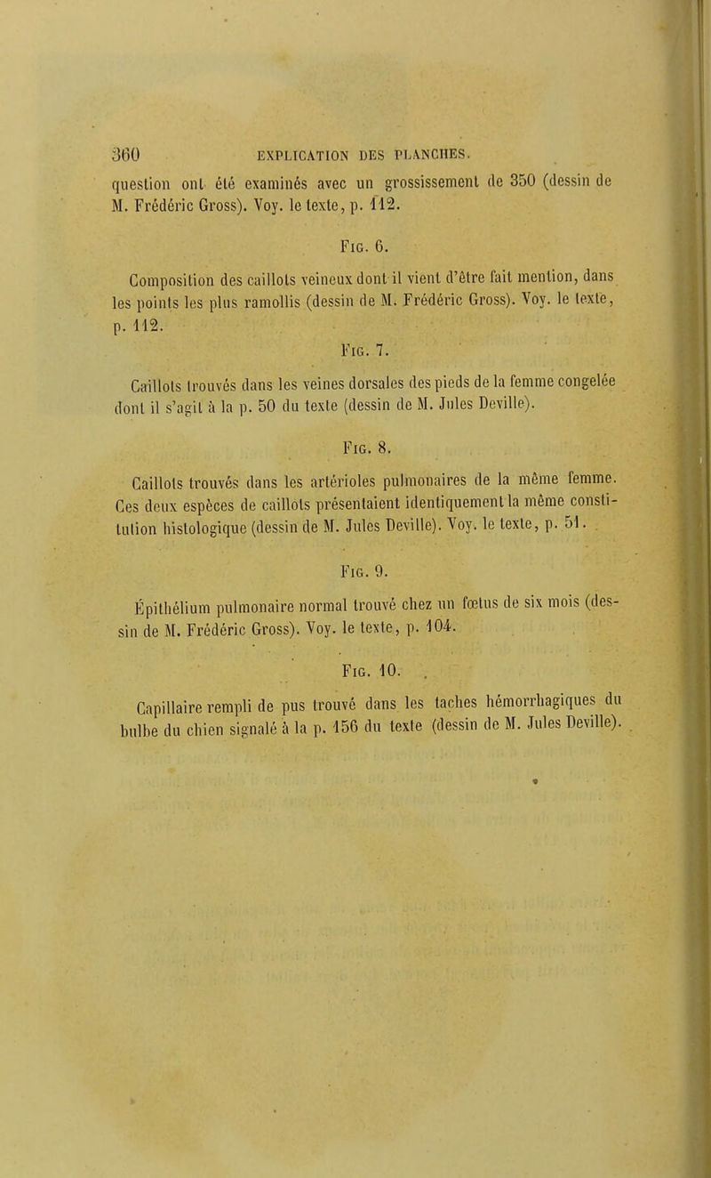 question onl été examinés avec un grossissement de 350 (dessin de M. Frédéric Gross). Voy. le texte, p. 112. FiG. 6. Composition des caillots veineux dont il vient d'être fait mention, dans les points les plus ramollis (dessin de M. Frédéric Gross). Voy. le texte, p. 112. FiG. 7. Caillots trouvés dans les veines dorsales des pieds de la femme congelée dont il s'agit à la p. 50 du texte (dessin de M. Jules Deville). FiG. 8. Caillots trouvés dans les artérioles pulmonaires de la même femme. Ces deux espèces de caillots présentaient identiquement la même consti- tution histologique (dessin de M. Jules Deville). Voy. le texte, p. 51. FiG. 9. Épithélium pulmonaire normal trouvé chez un fœtus de six mois (des- sin de M. Frédéric Gross). Voy. le texte, p. 104. FiG. 10. . Capillaire rempli de pus trouvé dans les taches hémorrhagiques du bulbe du chien signalé à la p. 156 du texte (dessin de M. Jules Deville).