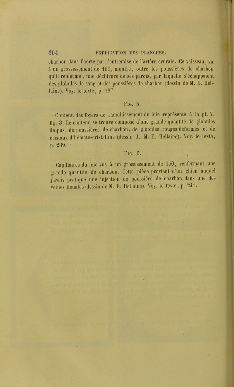 charbon dans l'aorle par l'entremise do l'artère crurale. Ce vaisseau, vu à un grossissement de 150, montre, outre les poussières de charbon qu'il renferme, une déchirure de ses parois, par laquelle s'échappaient des globules de sang et des poussières de charbon (dessin de M. E. Hel- laine). Voy. le texte, p. 187. FiG. 5. Contenu des foyers de ramollissement du foie représenté ù la pl. V, fig. 3. Ce contenu se trouve composé d'une grande quantité de globules de pus, de poussières de charbon, de globules rouges déformés et de cristaux d'hémato-crislalline (dessin de M. E. Hellaine). Voy. le texte, p. 239. Fig. 6. Capillaires du foie vus à un grossissement de 450, renfermant une grande quantité de charbon. Cette pièce provient d'un chien auquel j'avais pratiqué une injection de poussière de charbon dans une des veines liénales (dessin de M. E. Hellaine). Voy. le texte, p. 241.