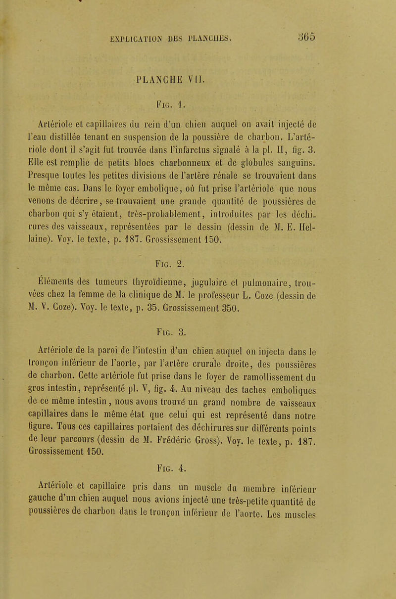 PLANCHE vu. FiG. i. Arlériole et capillaires du rein d'un chien auquel on avait injecté de l'eau dislillée tenant en suspension de la poussière de charbon. L'arté- riole dont il s'agit lut trouvée dans l'infarctus signalé à la pl. II, fig. 3. Elle est remplie de petits blocs charbonneux et de globules sanguins. Presque toutes les petites divisions de Partère rénale se trouvaient dans le même cas. Dans le foyer embolique, où fut prise l'artériole que nous venons de décrire, se trouvaient une grande quantité de poussières de charbon qui s'y étaient, très-probablement, iniroduites par les déchi- rures des vaisseaux, représentées par le dessin (dessin de M. E. Ilel- laine). Voy. le texte, p. 187. Grossissement 150. FiG. 2. Éléments des tumeurs thyroïdienne, jugulaire et pulmonaire, trou- vées chez la femme de la clinique de M. le professeur L. Goze (dessin de M. V. Goze). Voy. le texte, p. 35. Grossissement 350. FiG. 3. Arlériole de la paroi de l'inteslin d'un chien auquel on injecta dans le tronçon inférieur de Paorte, par l'artère crurale droite, des poussières de charbon. Cette arlériole fut prise dans le foyer de ramollissement du gros intestin, représenté pl. V, fig. 4. Au niveau des taches eraboliques de ce même intestin, nous avons trouvé un grand nombre de vaisseaux capillaires dans le même état que celui qui est représenté dans notre ligure. Tous ces capillaires portaient des déchirures sur différents points de leur parcours (dessin de M. Frédéric Gross). Voy. le texte, p. 187. Grossissement 150. Fig. 4. Arlériole et capillaire pris dans un muscle du membre inférieur gauche d'un chien auquel nous avions injecté une très-petite quantité de poussières de charbon dans le tronçon inférieur de Paorte. Les muscles